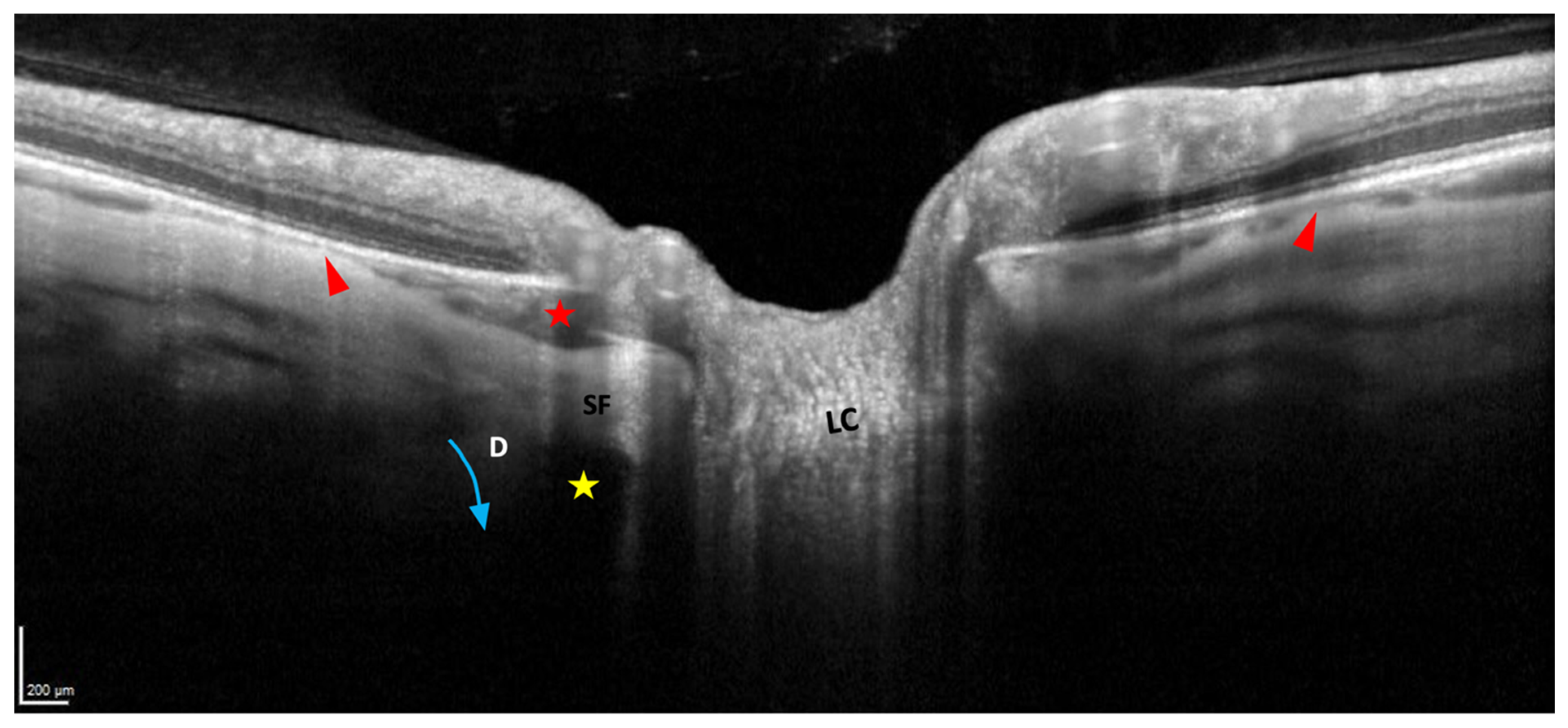 Jcm 12 04712 g008 Jcm 12 04712 g008