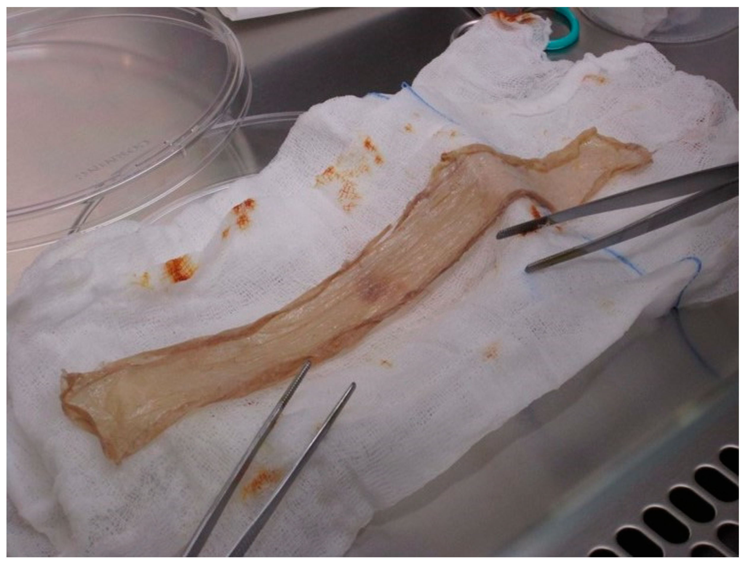 Jcm 12 04717 g002 Jcm 12 04717 g002