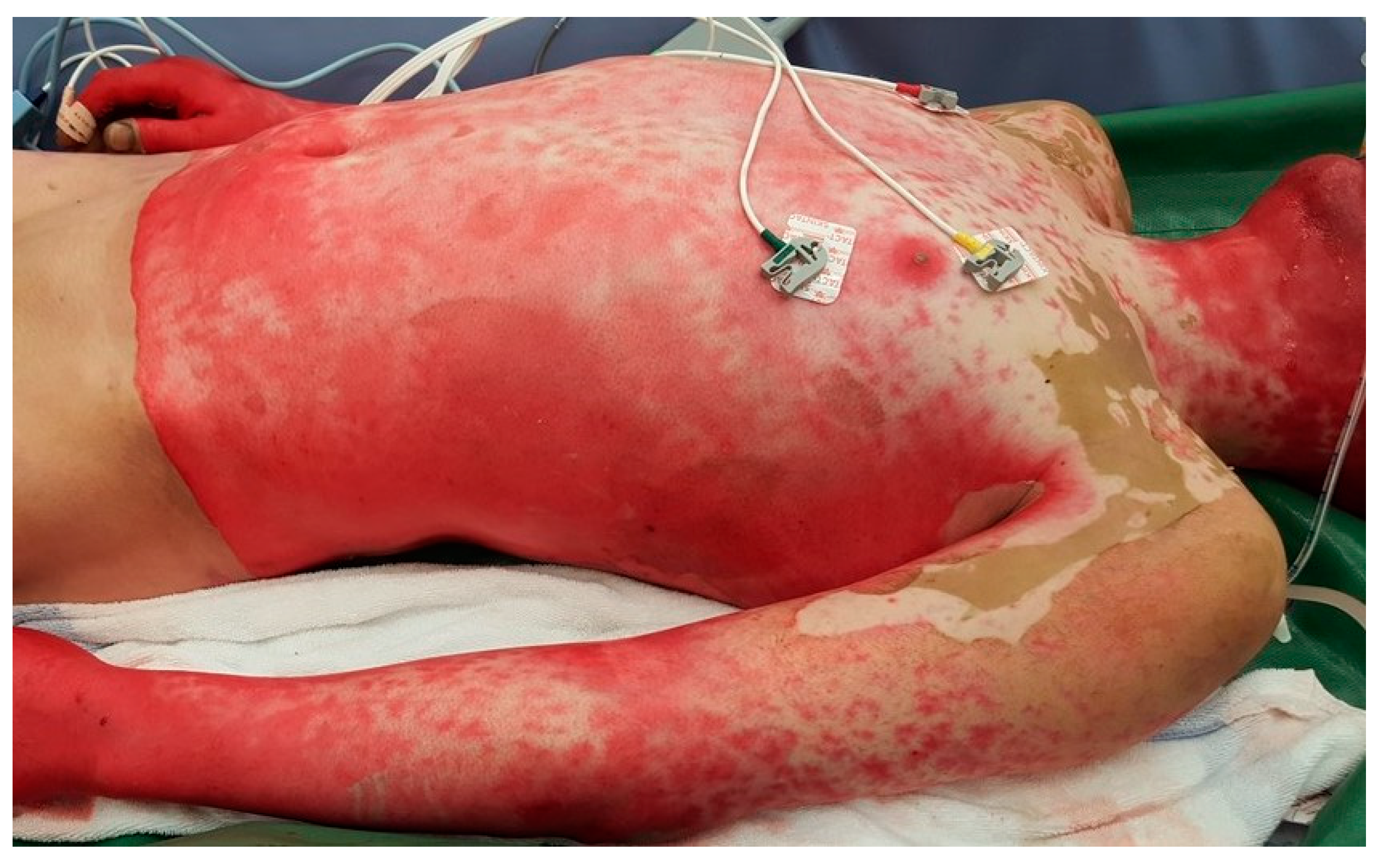 Jcm 12 04717 g003 Jcm 12 04717 g003