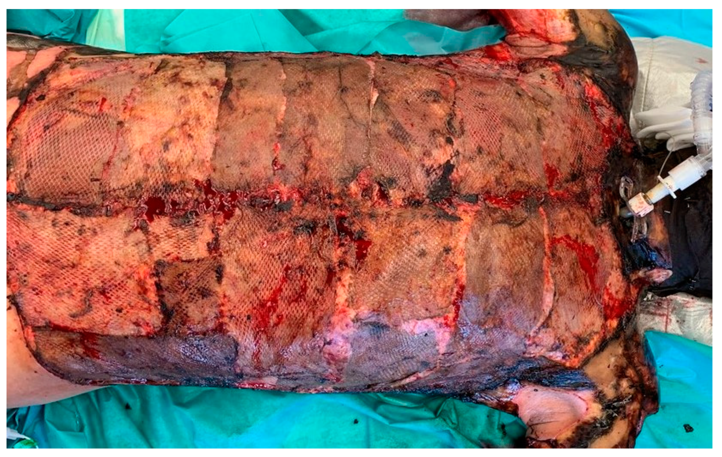 Jcm 12 04717 g004 Jcm 12 04717 g004