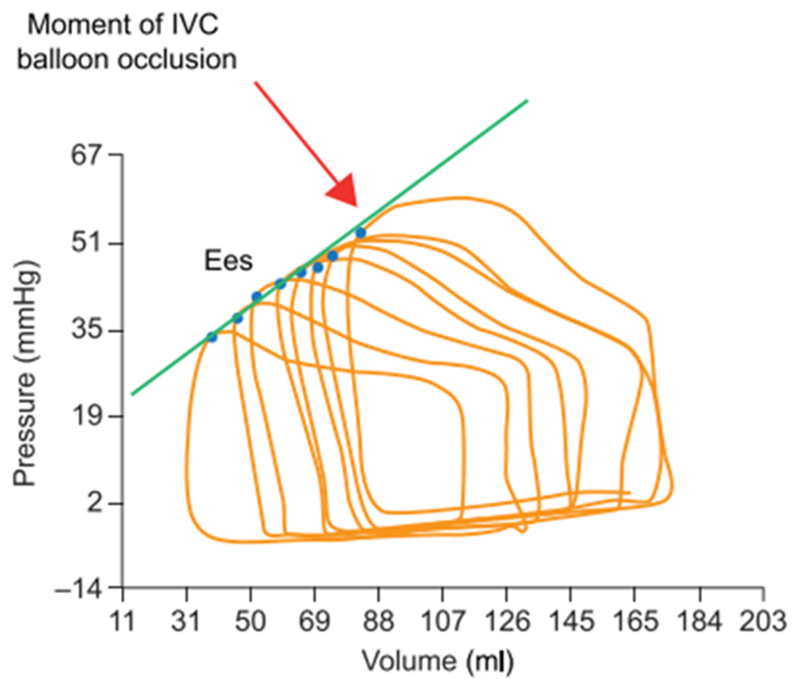 JCM Free FullText Pressure Overload and Right Ventricular Failure