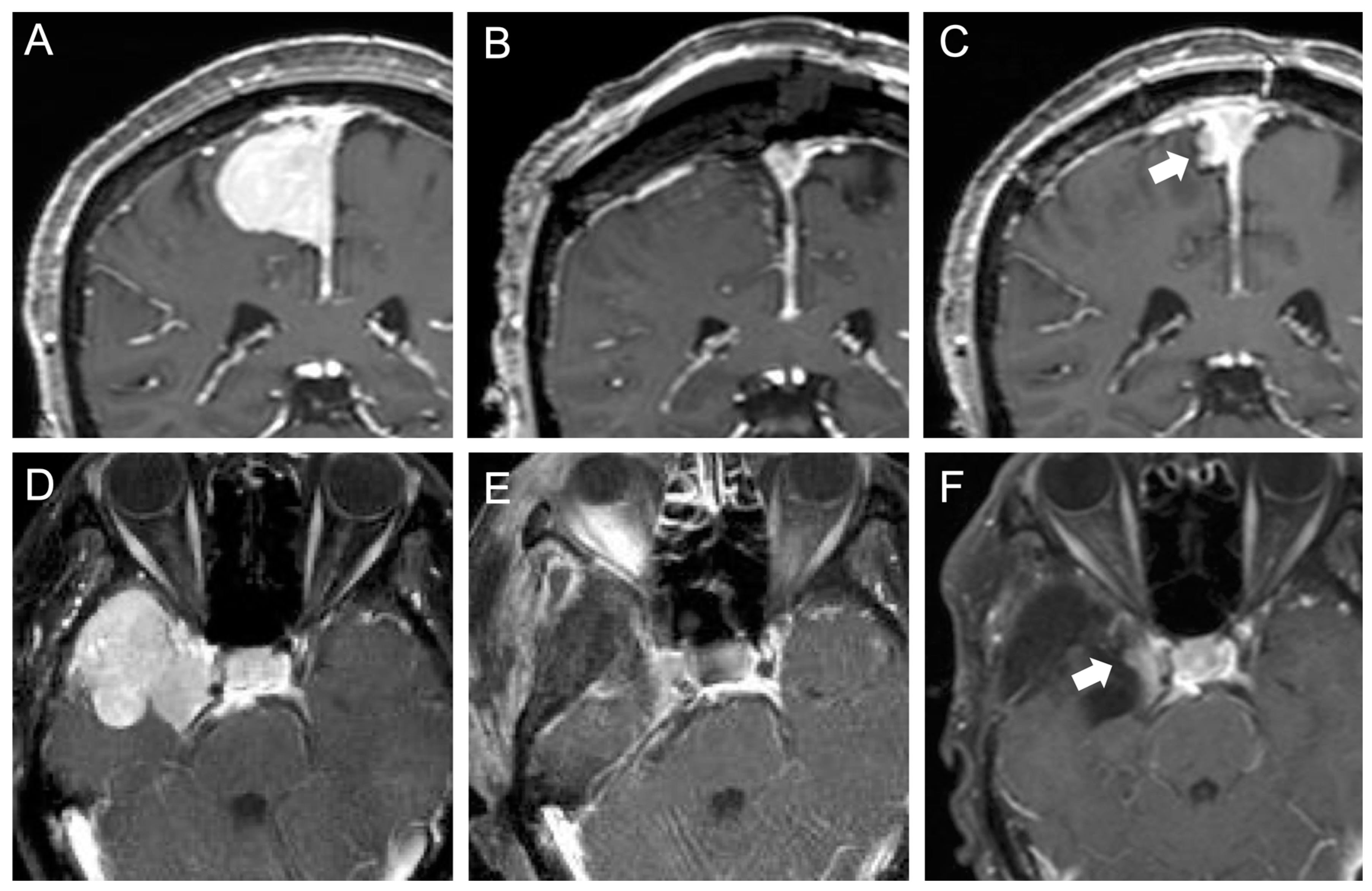Jcm 12 04733 g003 Jcm 12 04733 g003