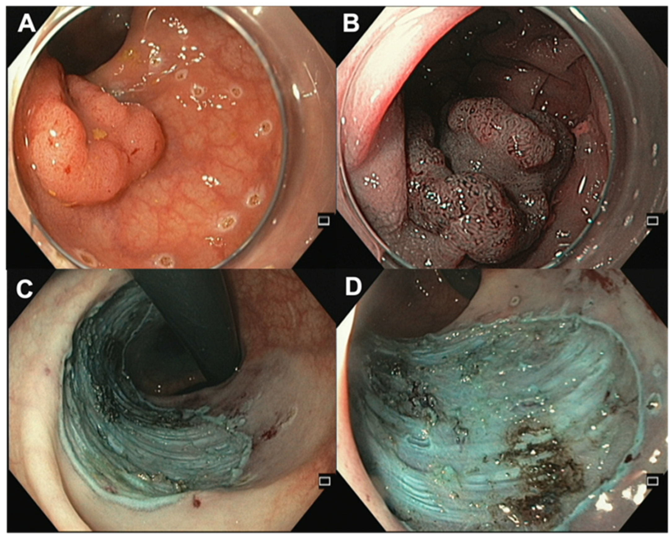 Jcm 12 04777 g004 Jcm 12 04777 g004