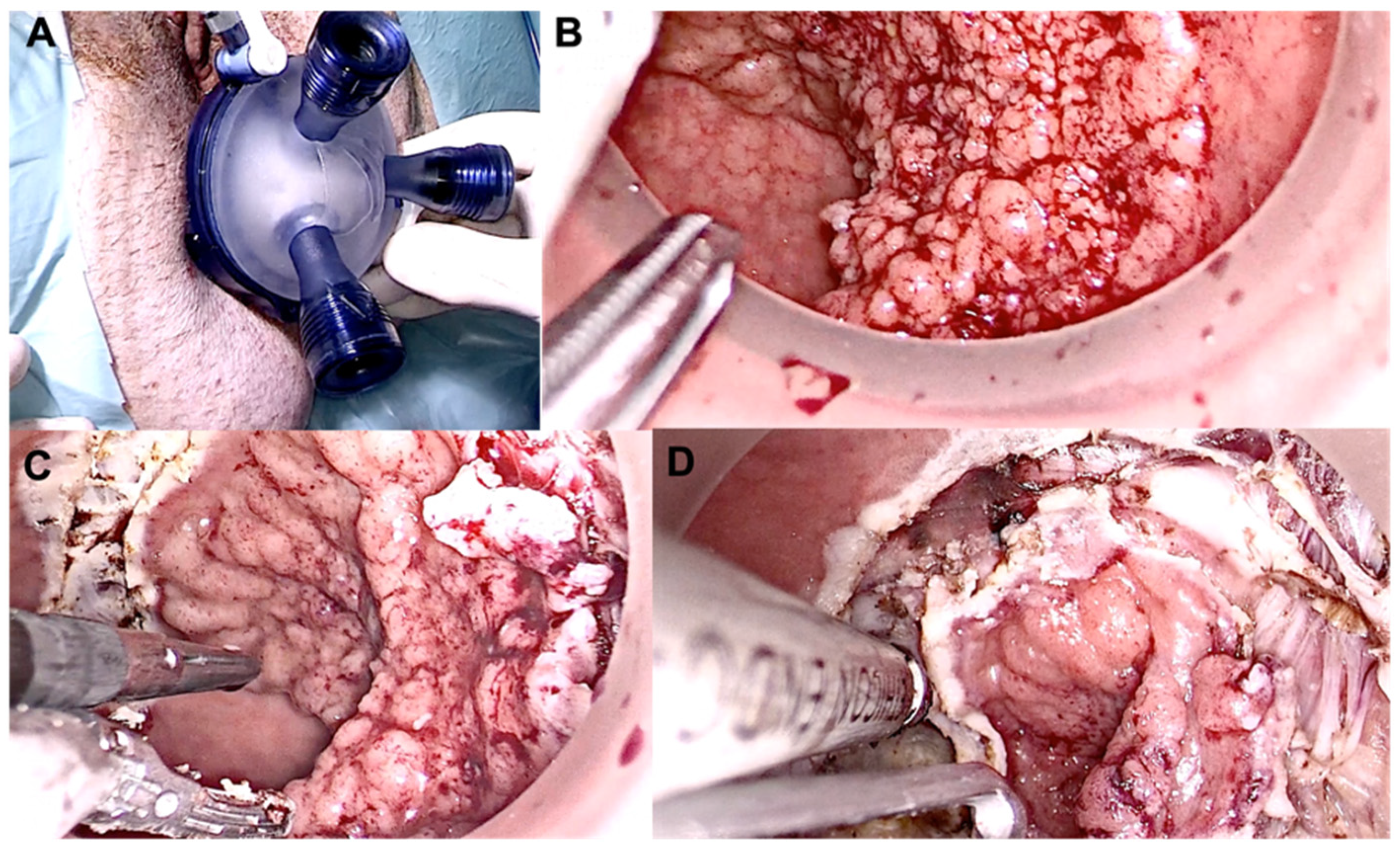 Jcm 12 04777 g005 Jcm 12 04777 g005