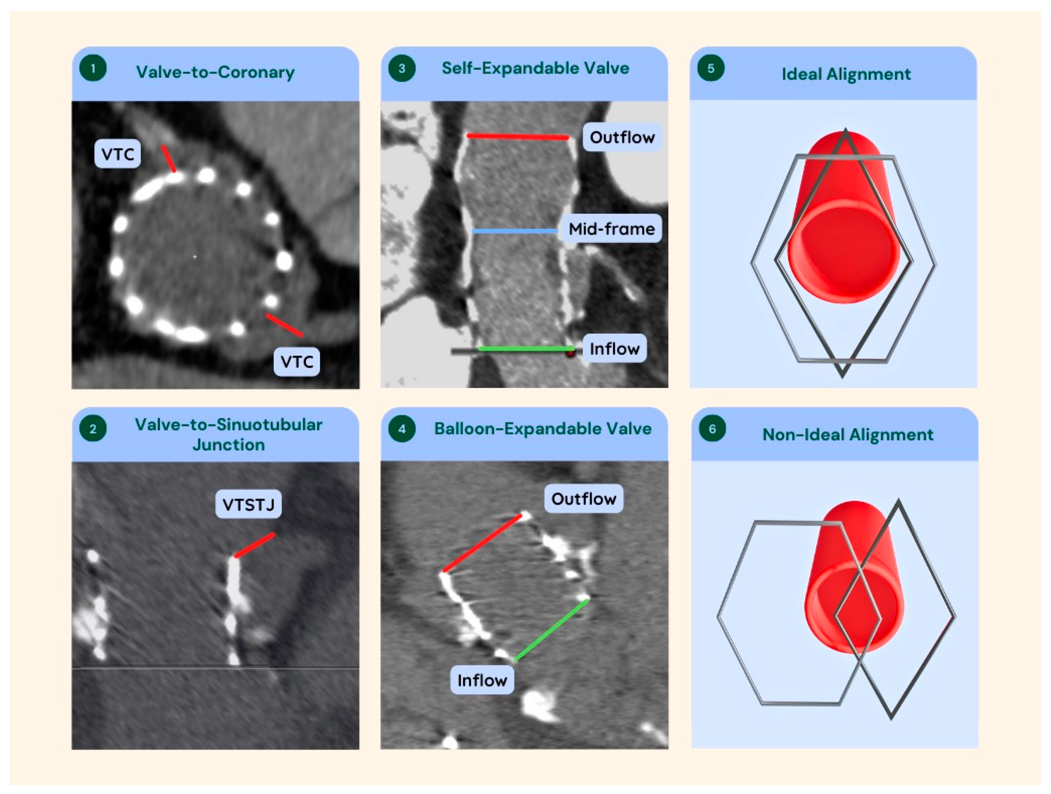 Jcm 12 04788 g002 Jcm 12 04788 g002