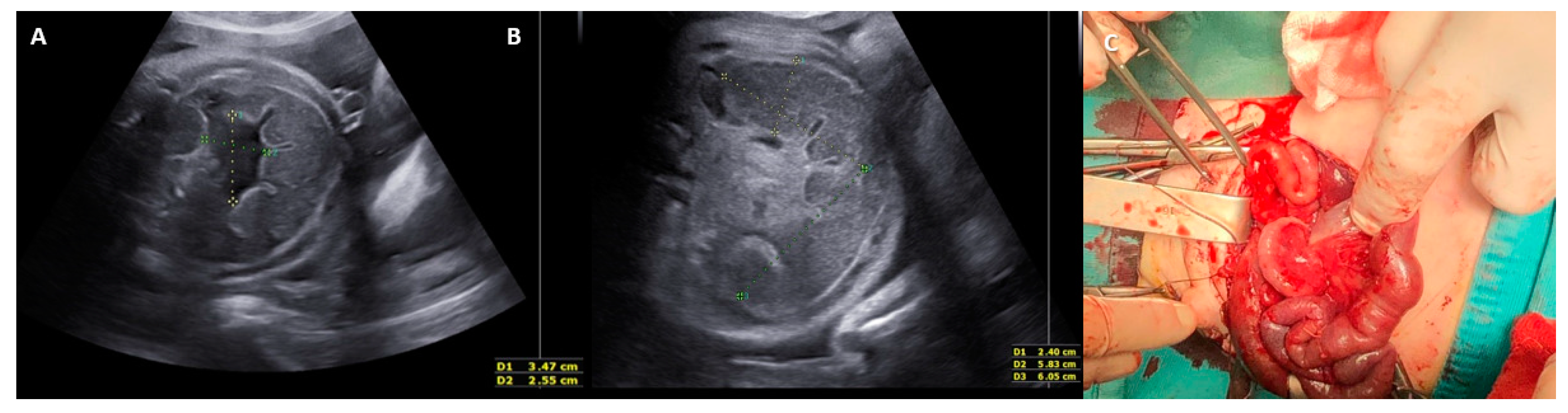 Jcm 12 04790 g002 Jcm 12 04790 g002