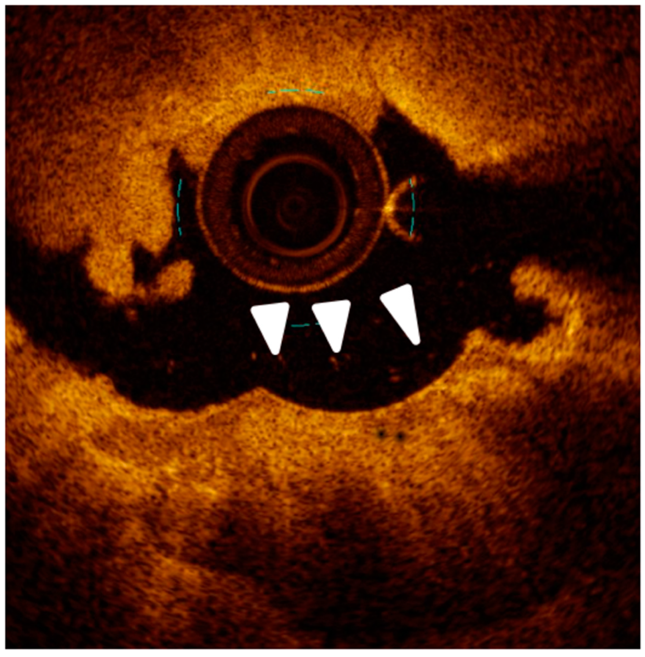 Jcm 12 04844 g005 Jcm 12 04844 g005