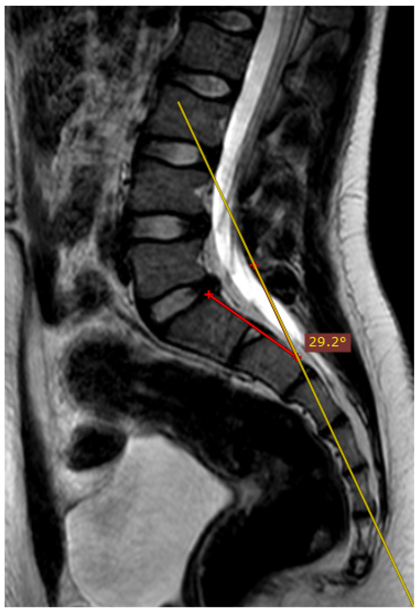 Jcm 12 04852 g005 Jcm 12 04852 g005