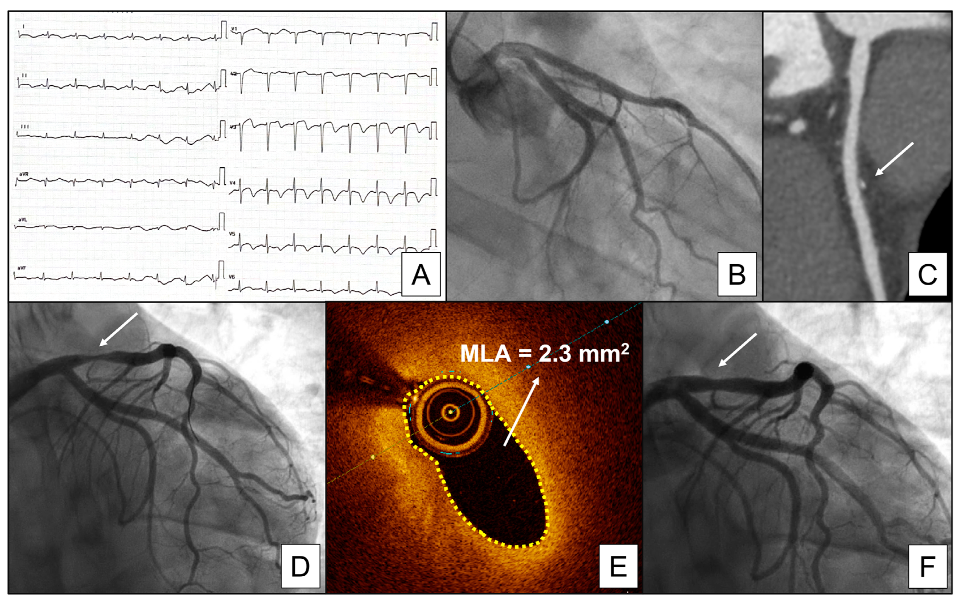 Jcm 12 04864 g003 Jcm 12 04864 g003