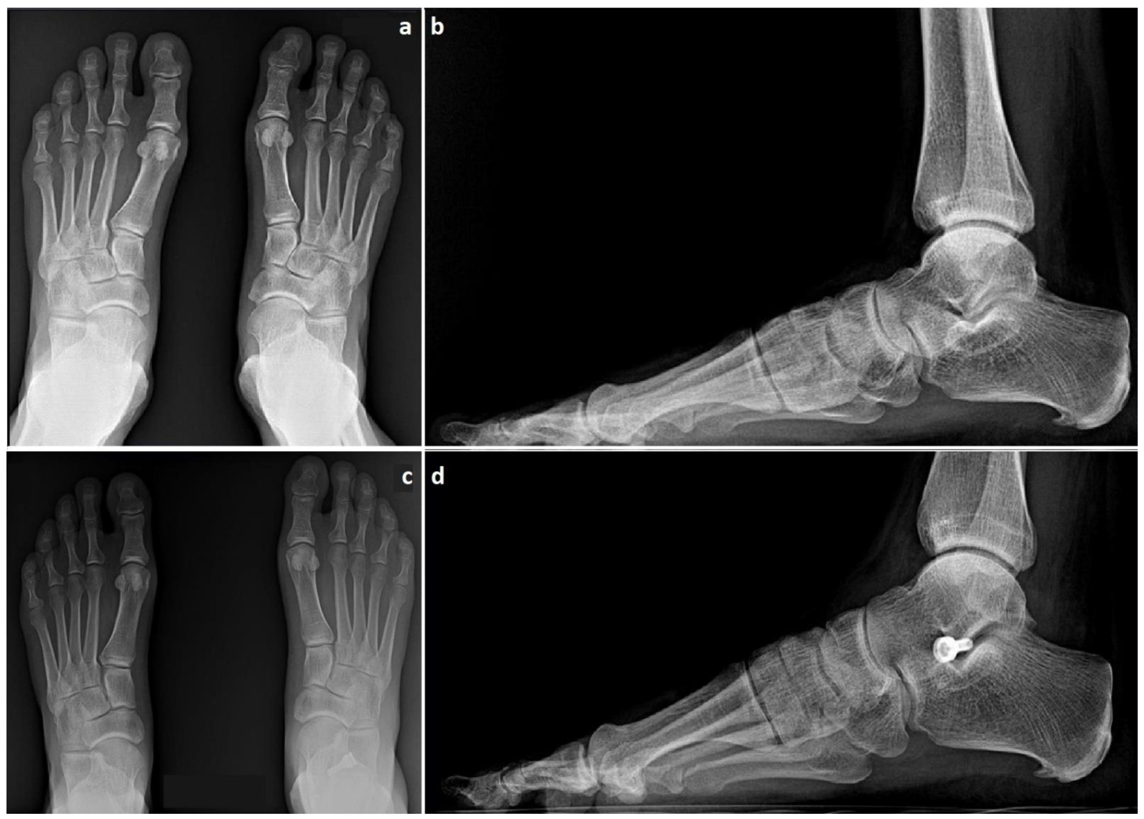 Jcm 12 04872 g002 Jcm 12 04872 g002