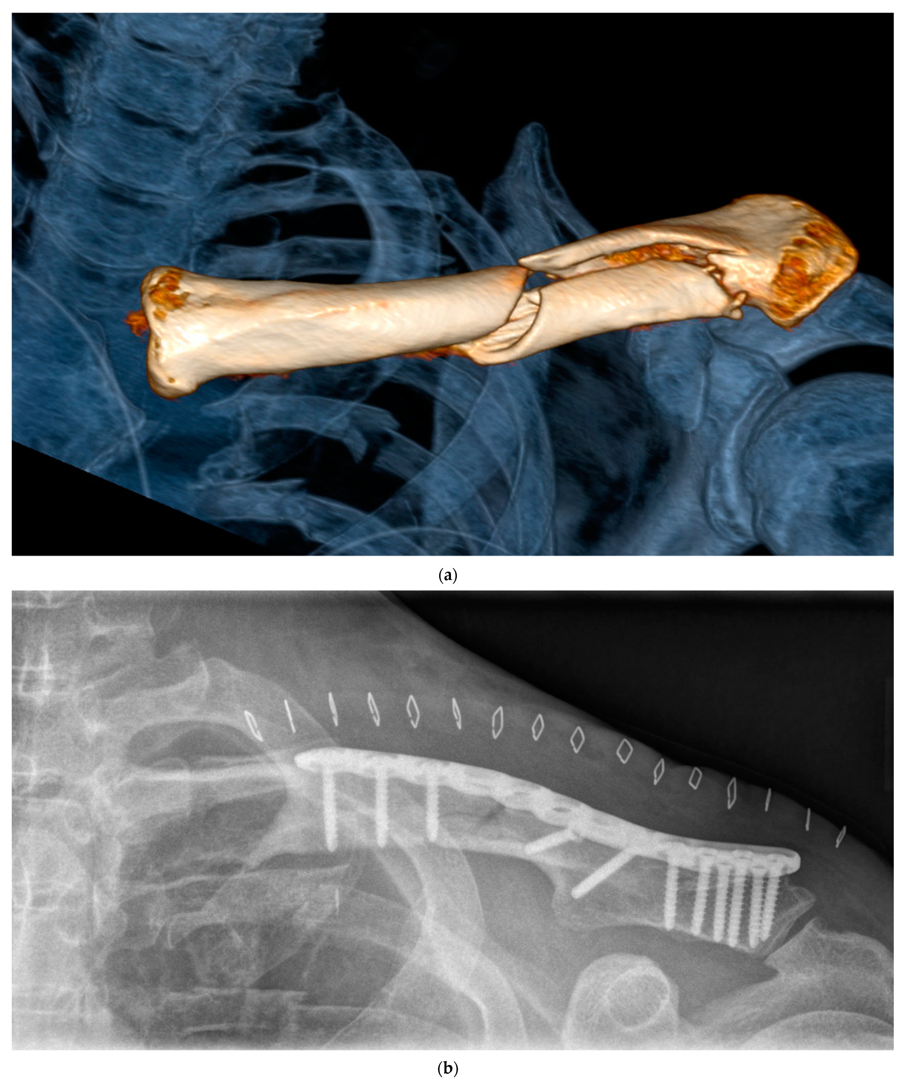 Jcm 12 04878 g001a Jcm 12 04878 g001a