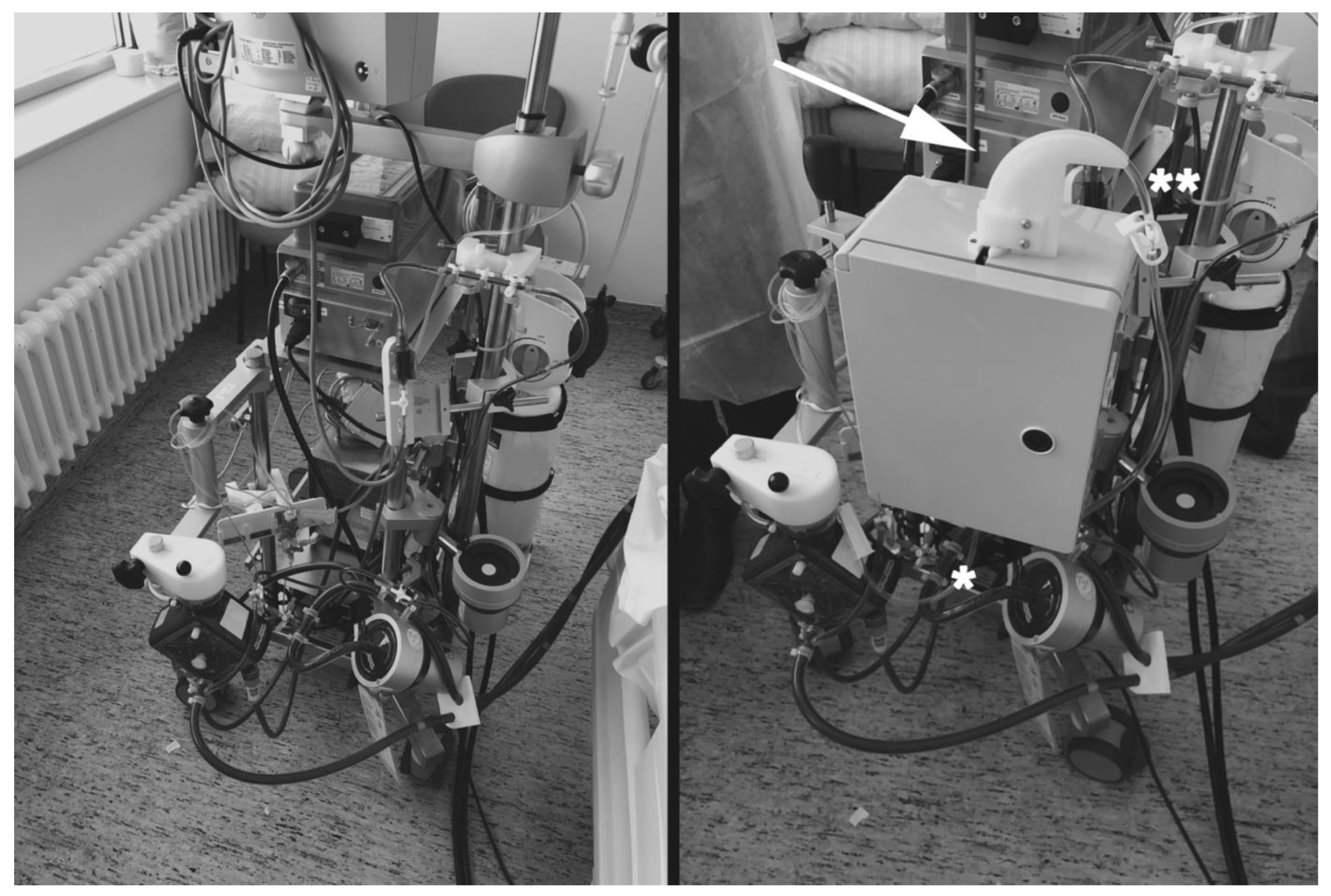 Impact of a VA–ECMO in Combination with an Extracorporeal