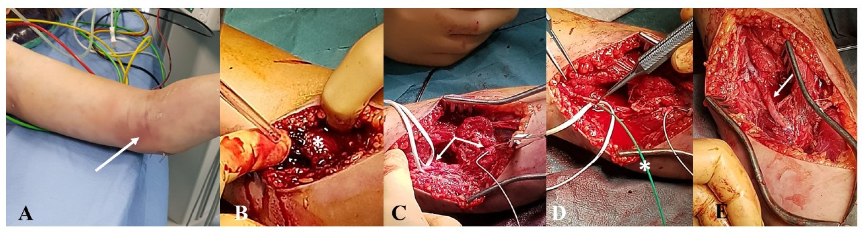 Jcm 12 04906 g002 Jcm 12 04906 g002