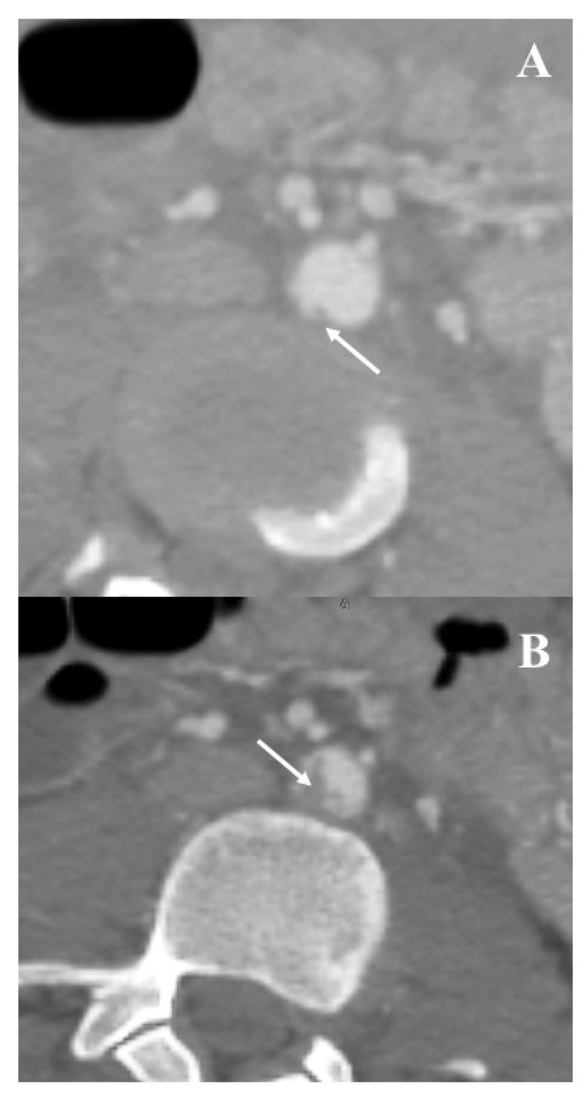 Jcm 12 04906 g003 Jcm 12 04906 g003
