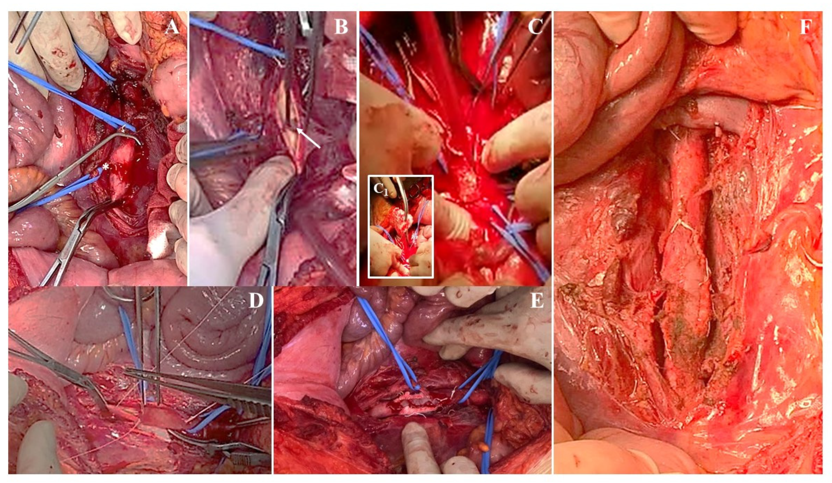 Jcm 12 04906 g005 Jcm 12 04906 g005