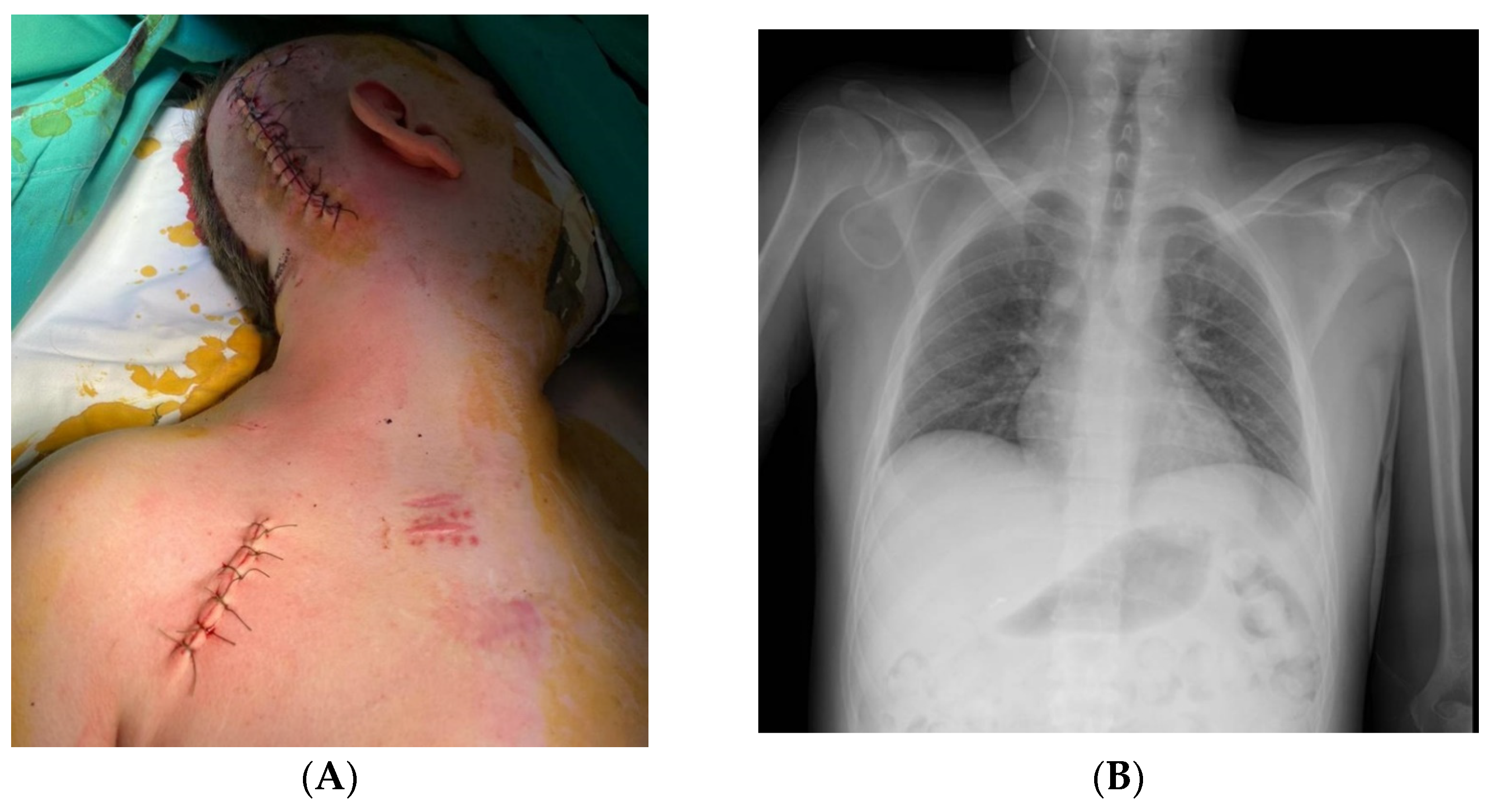 Jcm 12 04919 g005 Jcm 12 04919 g005