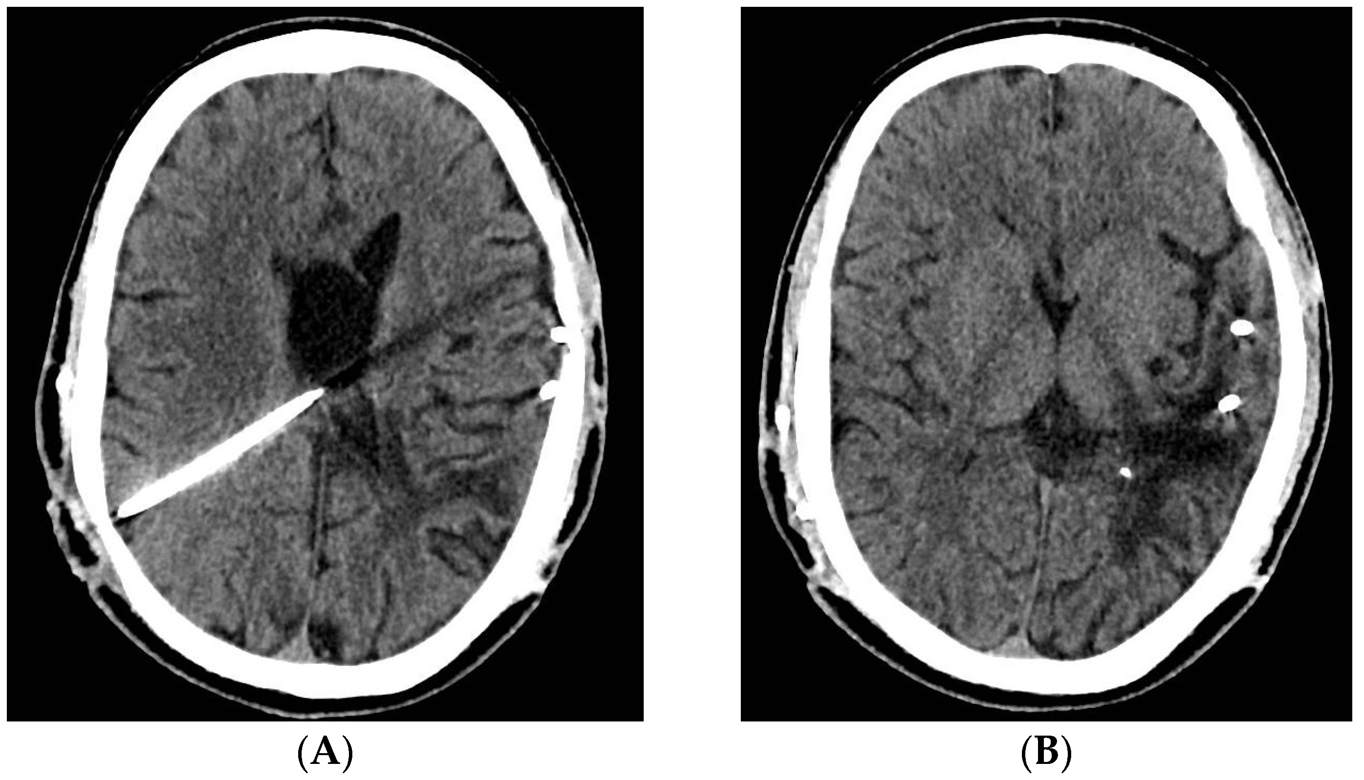 Jcm 12 04919 g006 Jcm 12 04919 g006