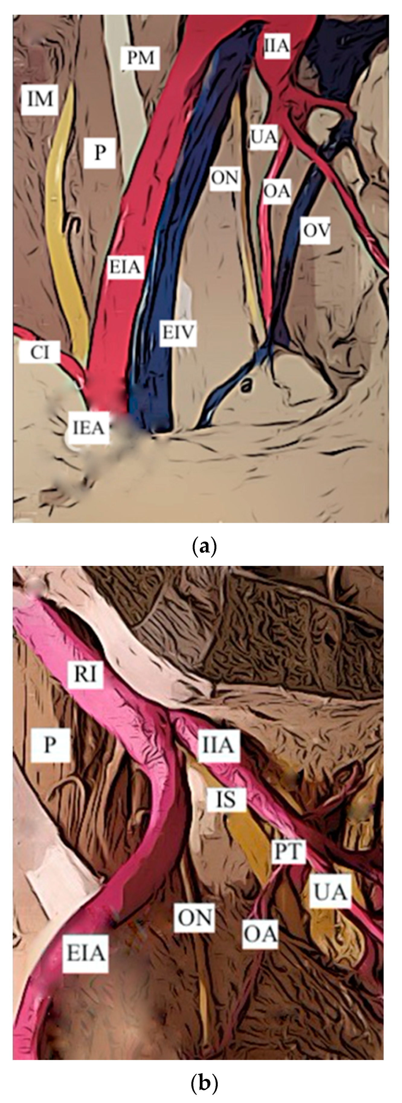 Jcm 12 04932 g005a Jcm 12 04932 g005a