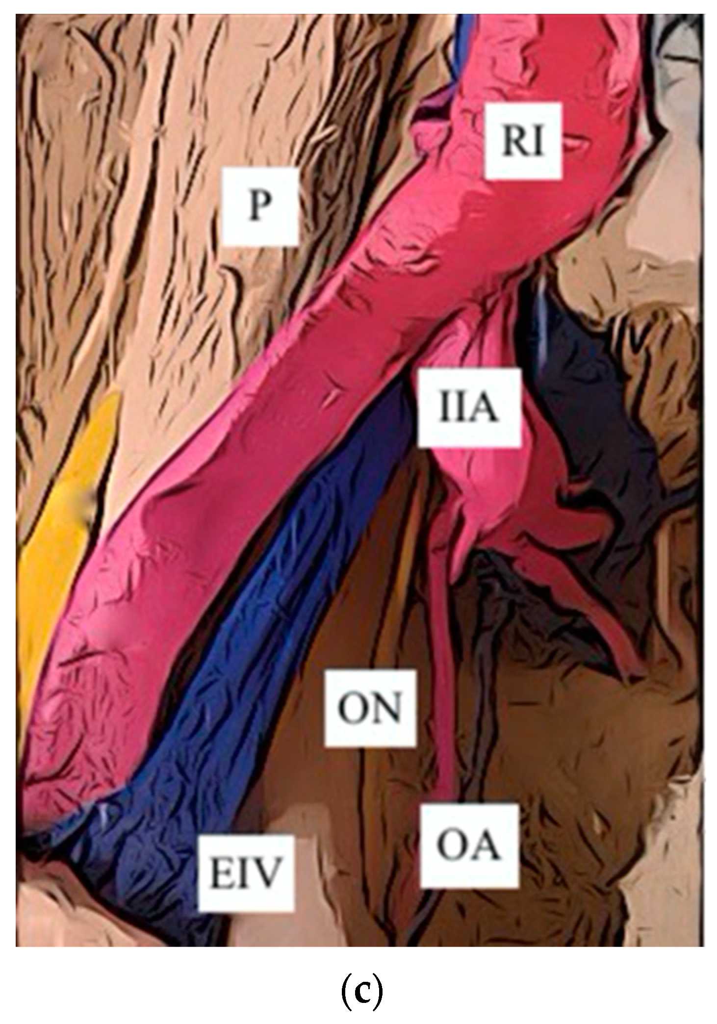 Jcm 12 04932 g005b Jcm 12 04932 g005b