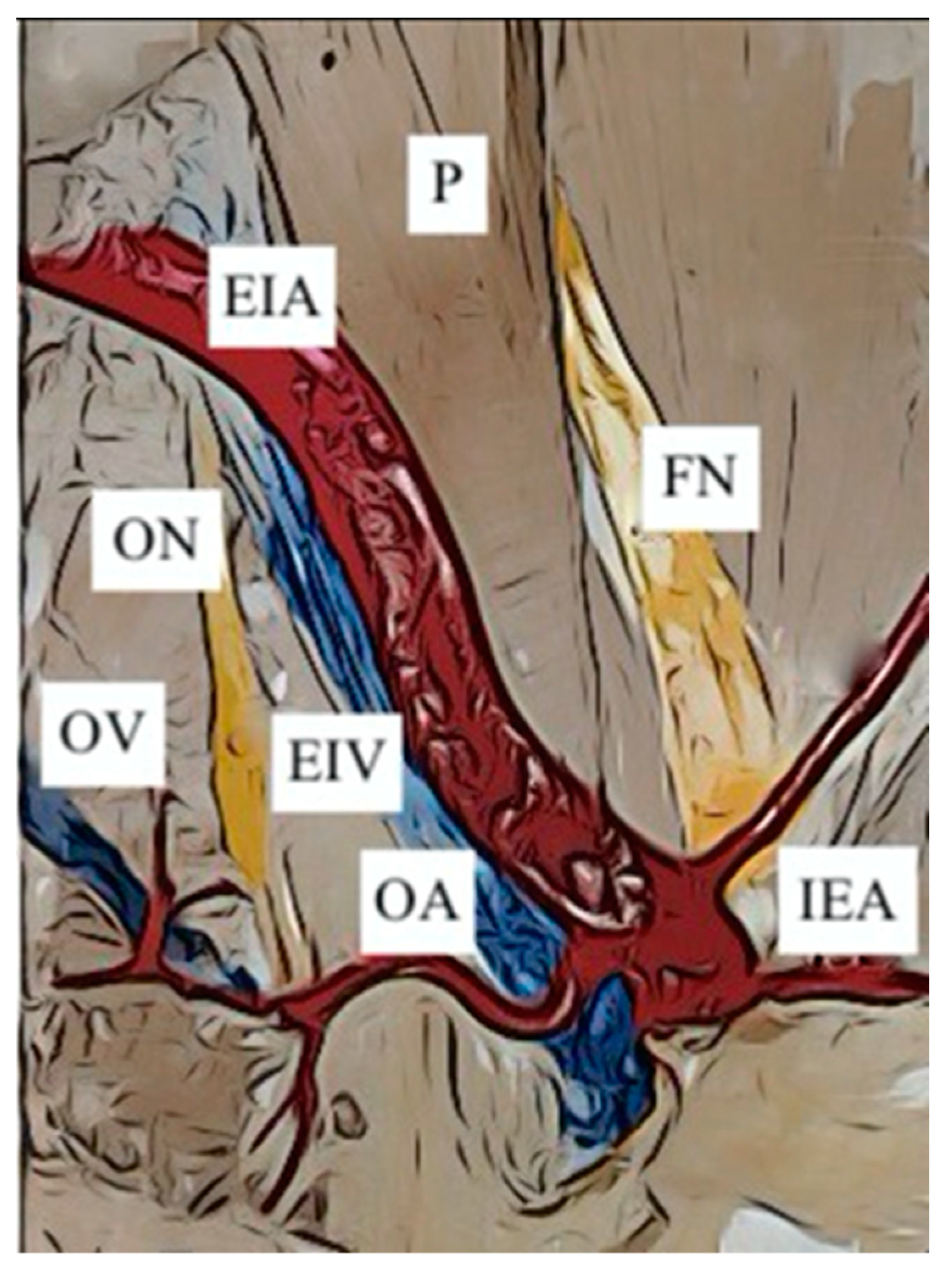 Jcm 12 04932 g010 Jcm 12 04932 g010