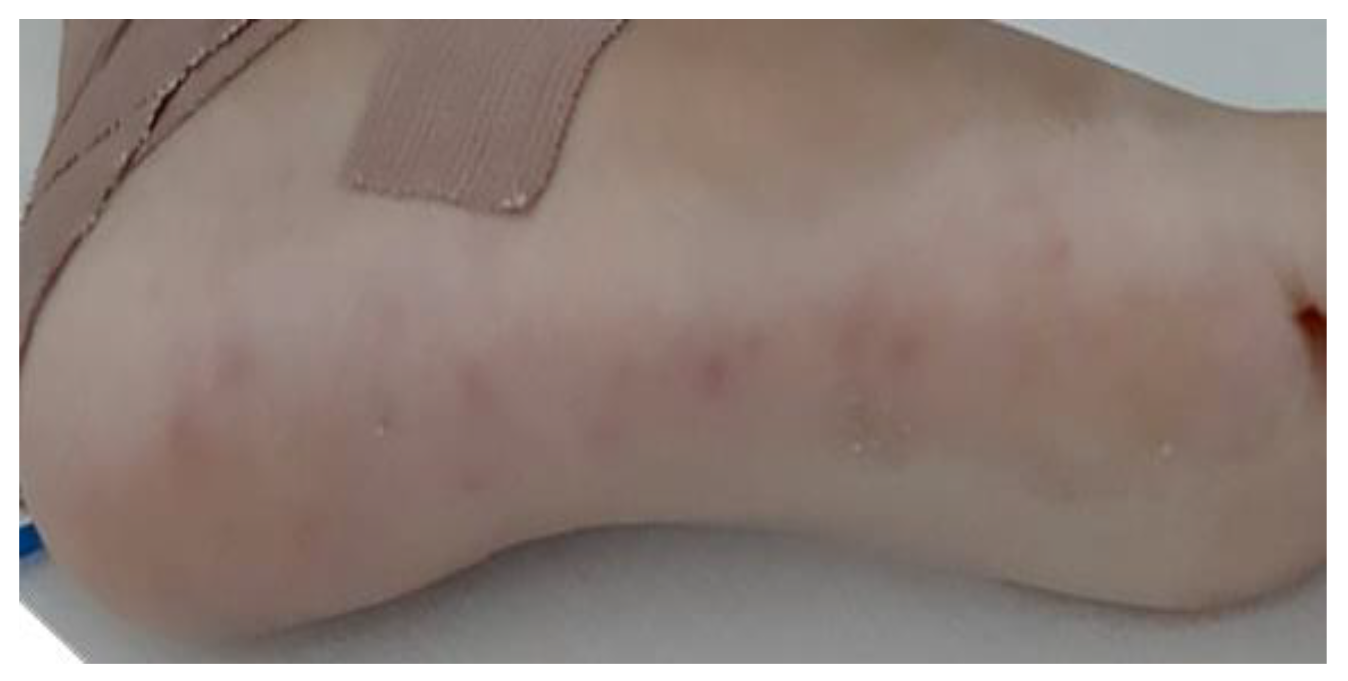 Jcm 12 04941 g003 Jcm 12 04941 g003