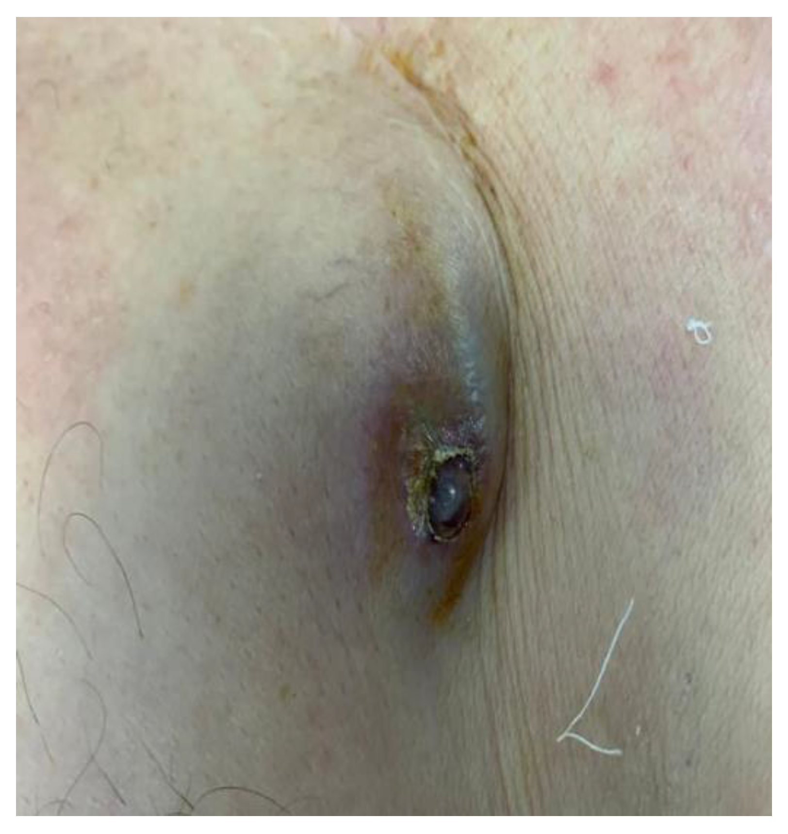 Jcm 12 04941 g004 Jcm 12 04941 g004