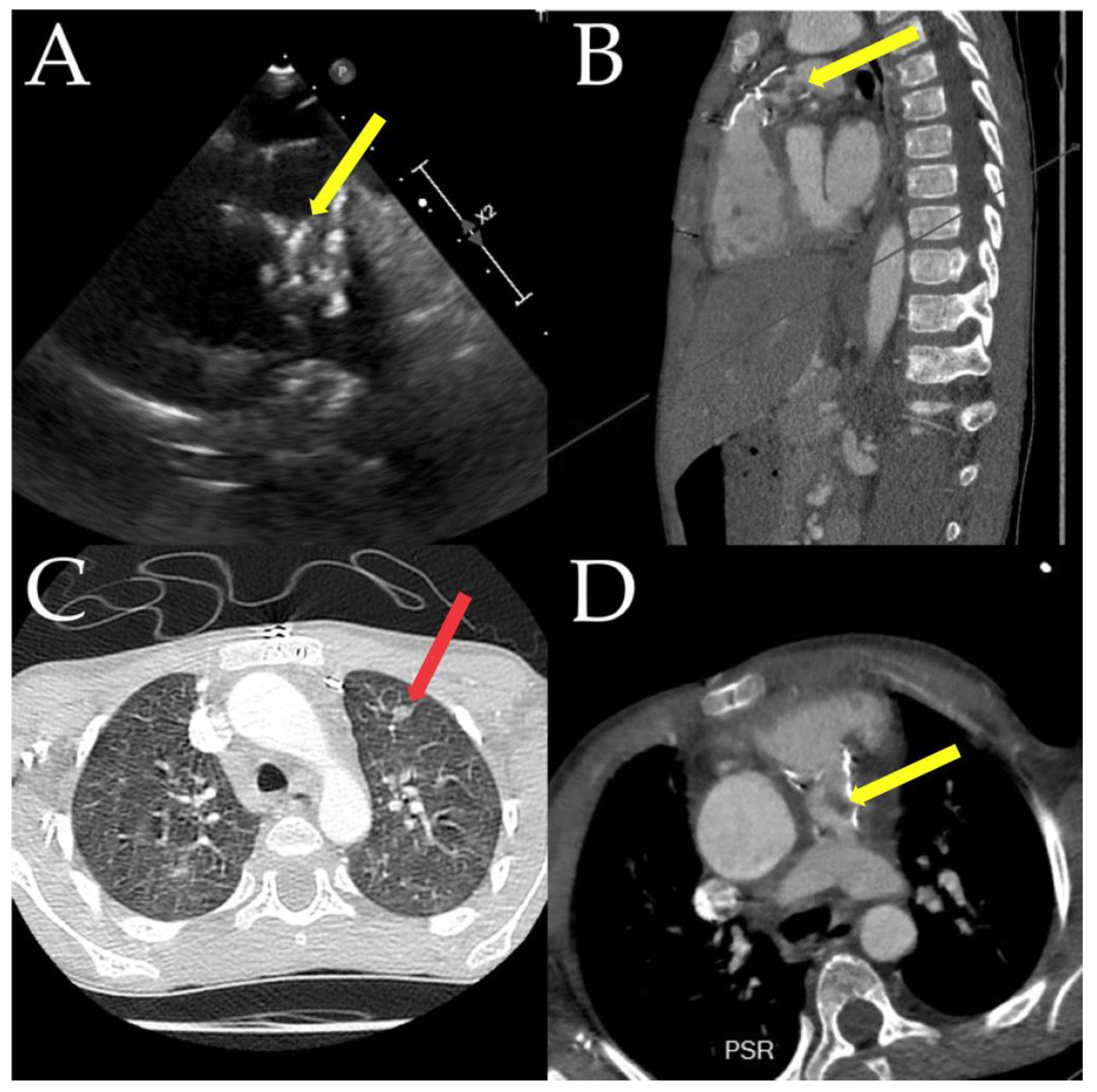 Jcm 12 04941 g007 Jcm 12 04941 g007