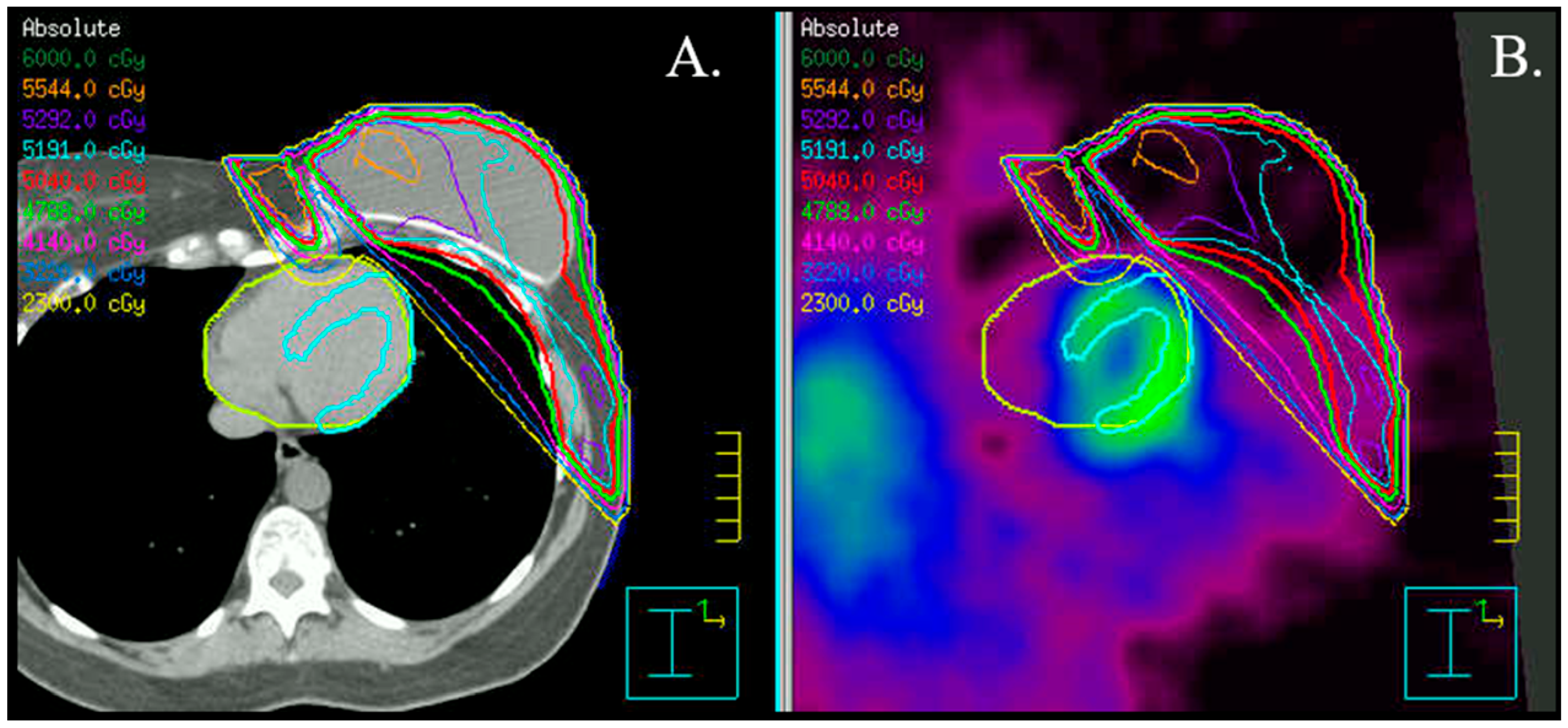 Jcm 12 04945 g003 Jcm 12 04945 g003