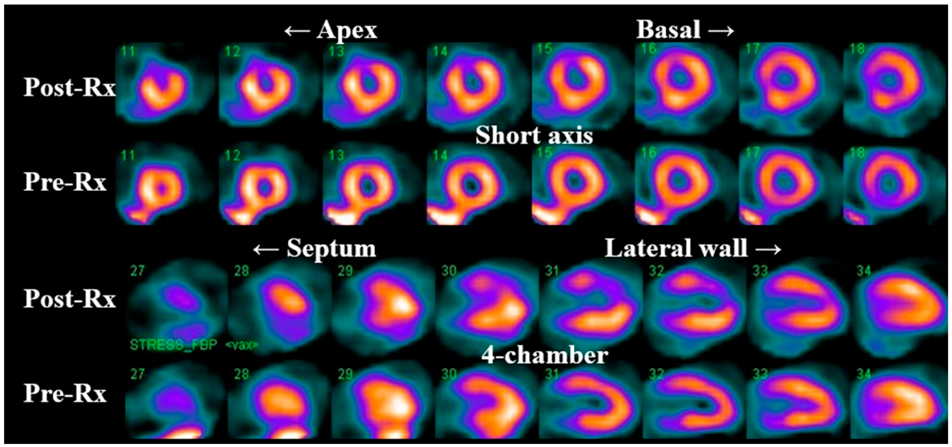 Jcm 12 04945 g004 Jcm 12 04945 g004