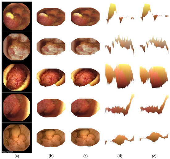 Challenges of 3D Surface Reconstruction in Capsule Endoscopy