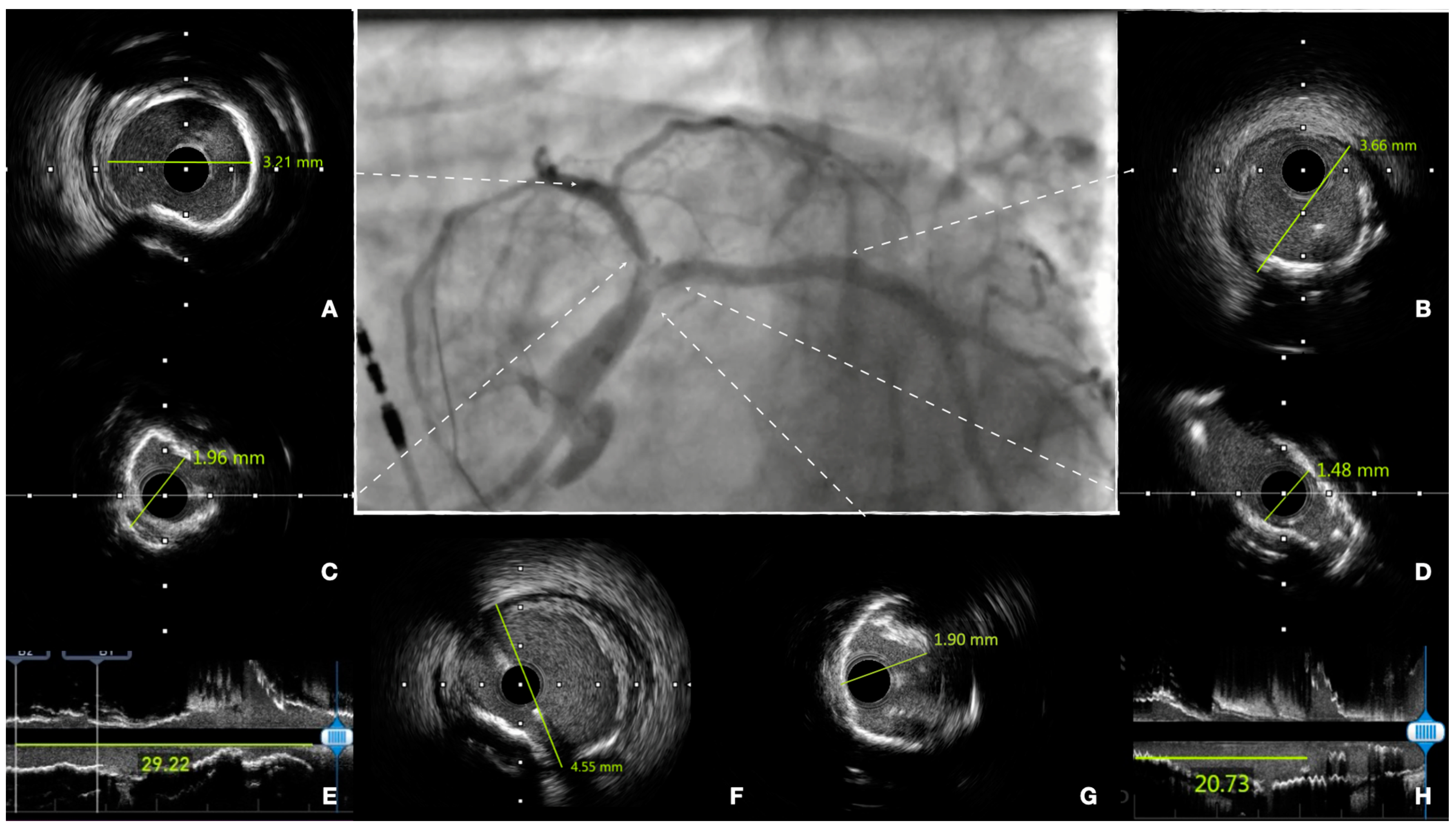 Jcm 12 04972 g002 Jcm 12 04972 g002