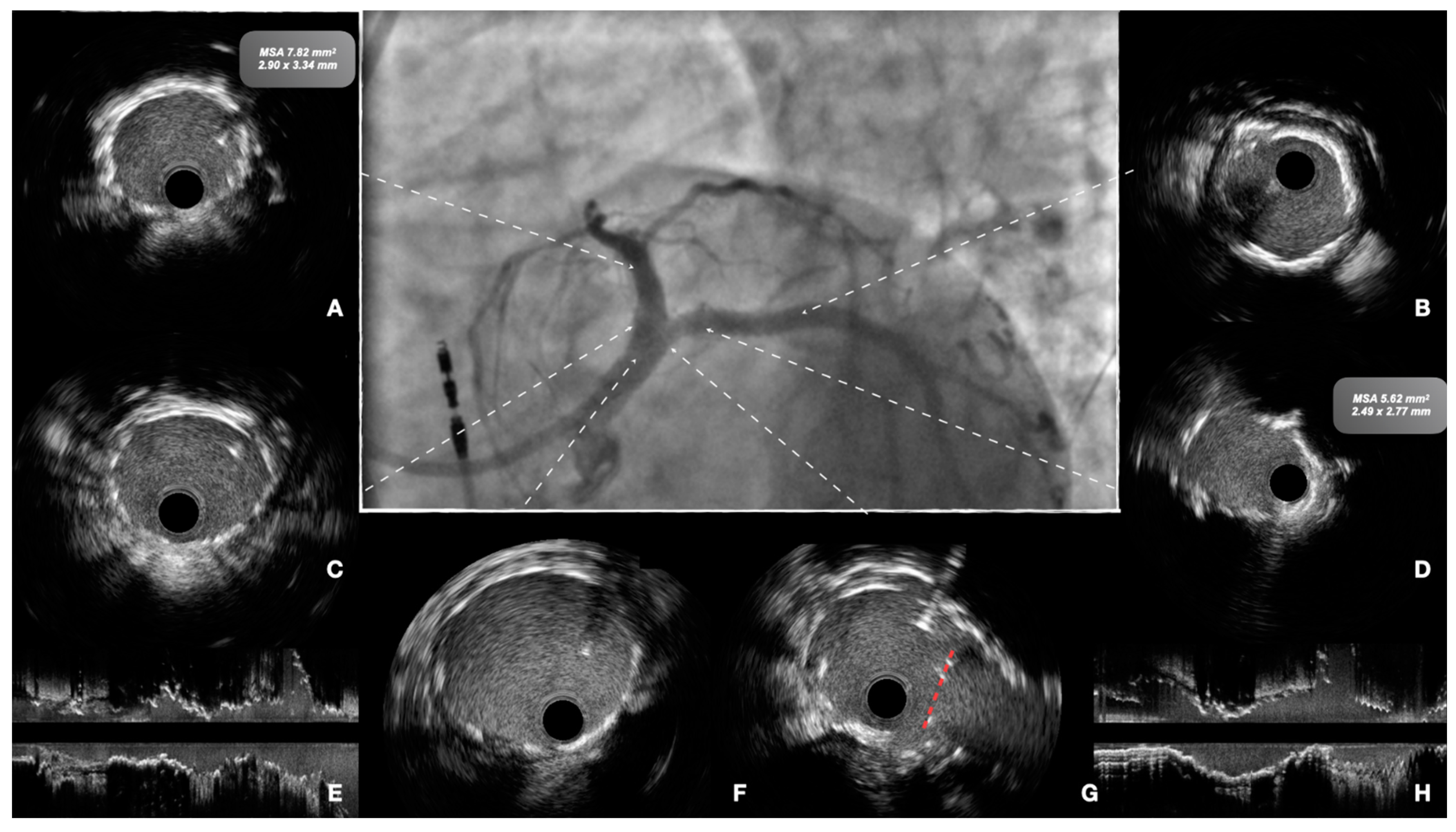 Jcm 12 04972 g004 Jcm 12 04972 g004