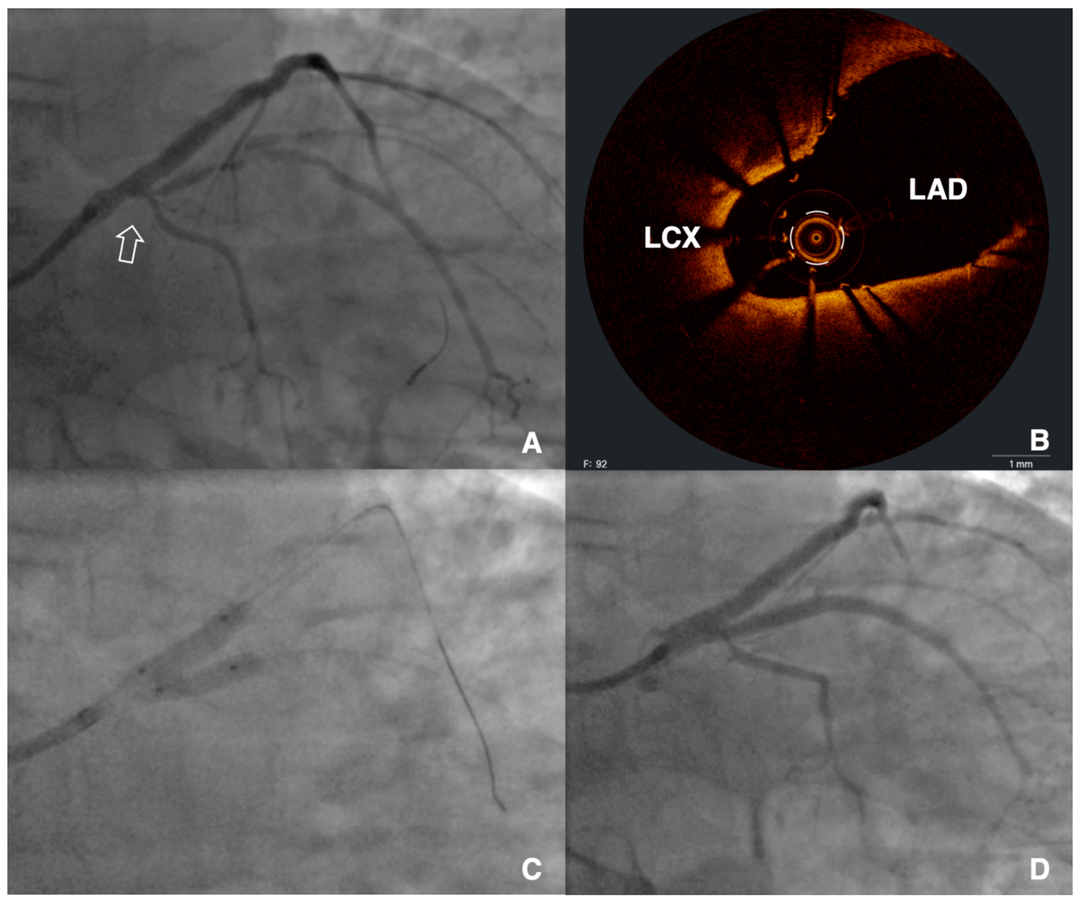 Jcm 12 04972 g005 Jcm 12 04972 g005