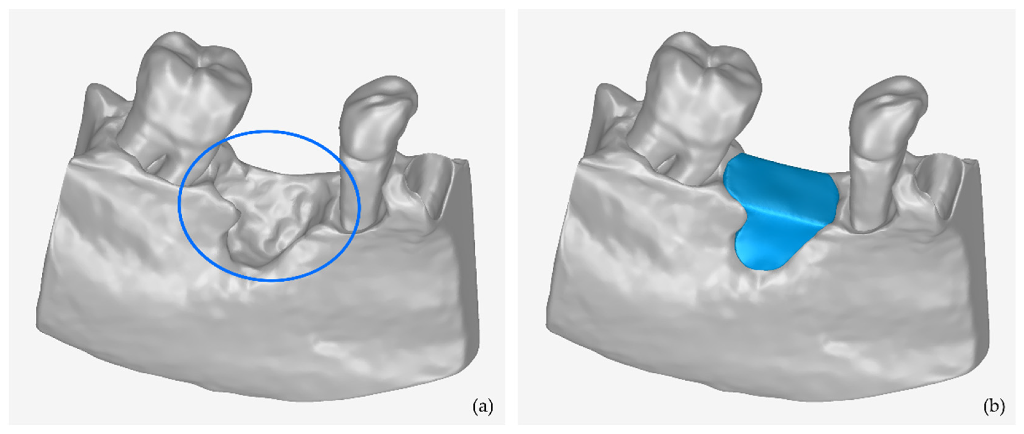 Jcm 12 05023 g010 Jcm 12 05023 g010