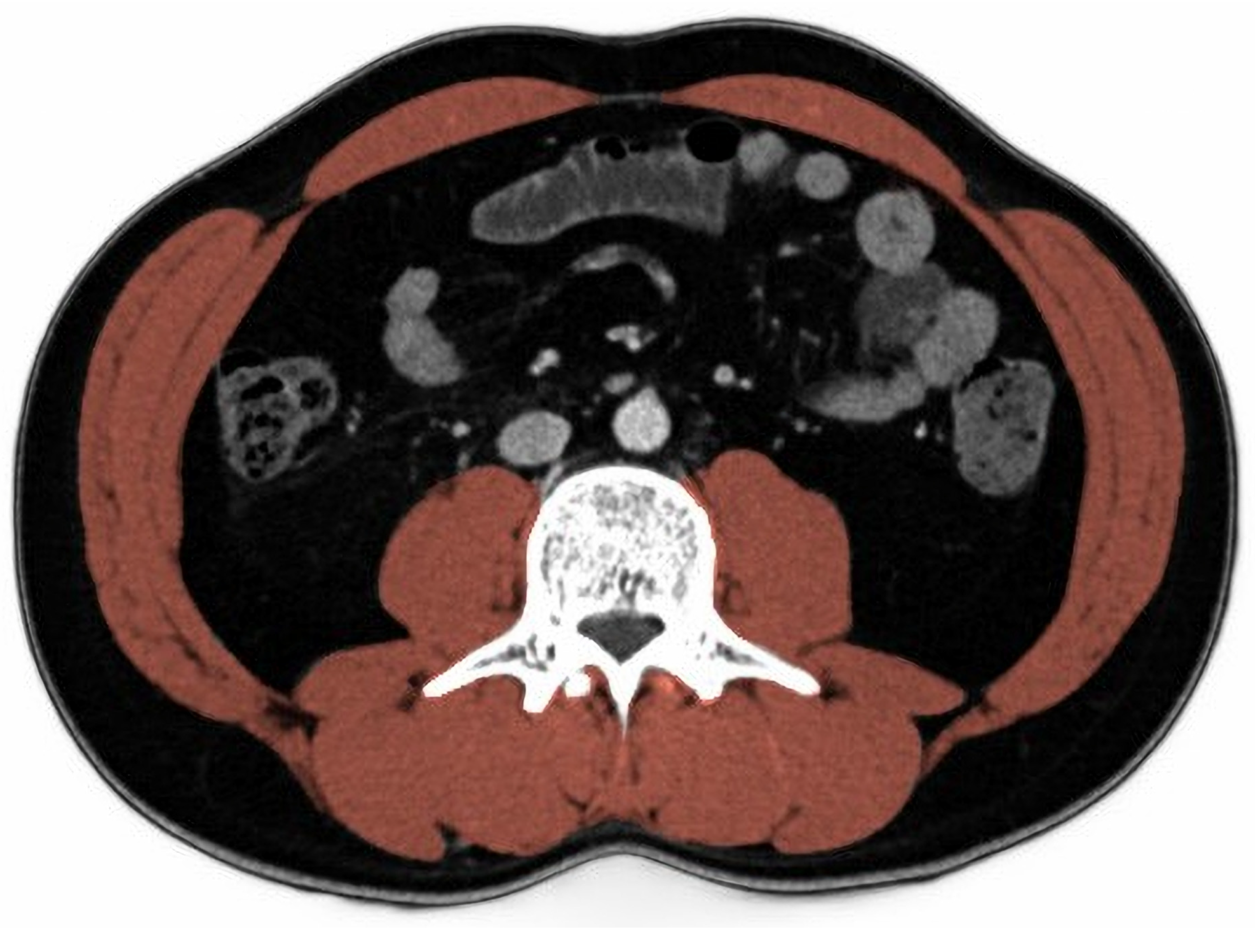 Jcm 12 05024 g001 Jcm 12 05024 g001