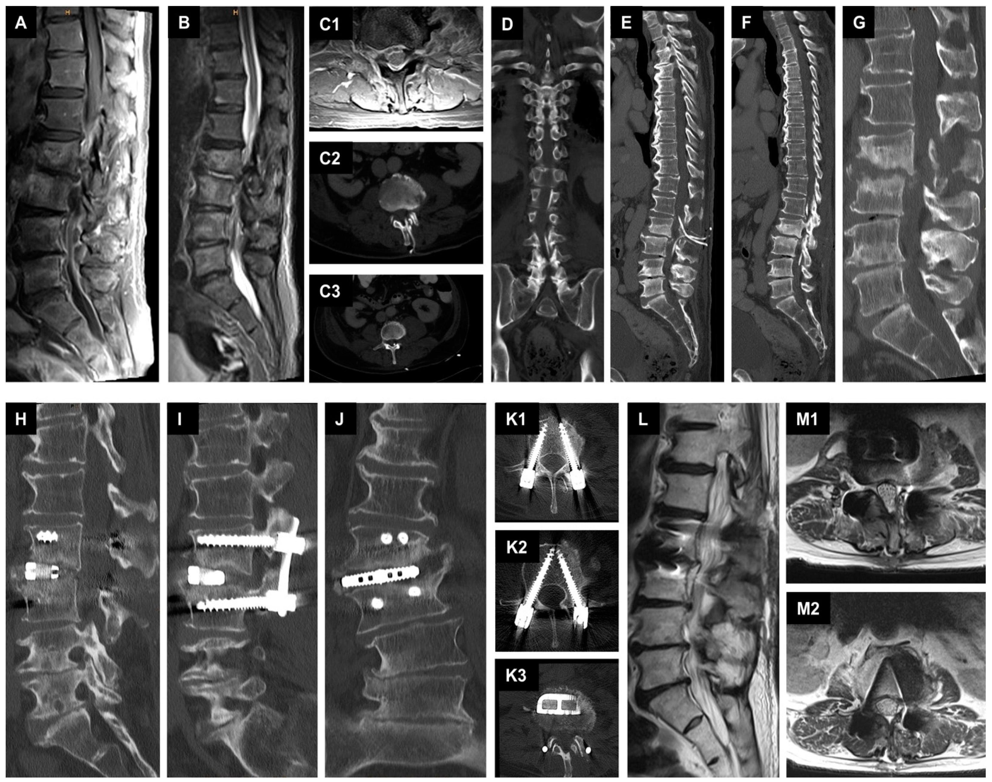 Jcm 12 05078 g002 Jcm 12 05078 g002
