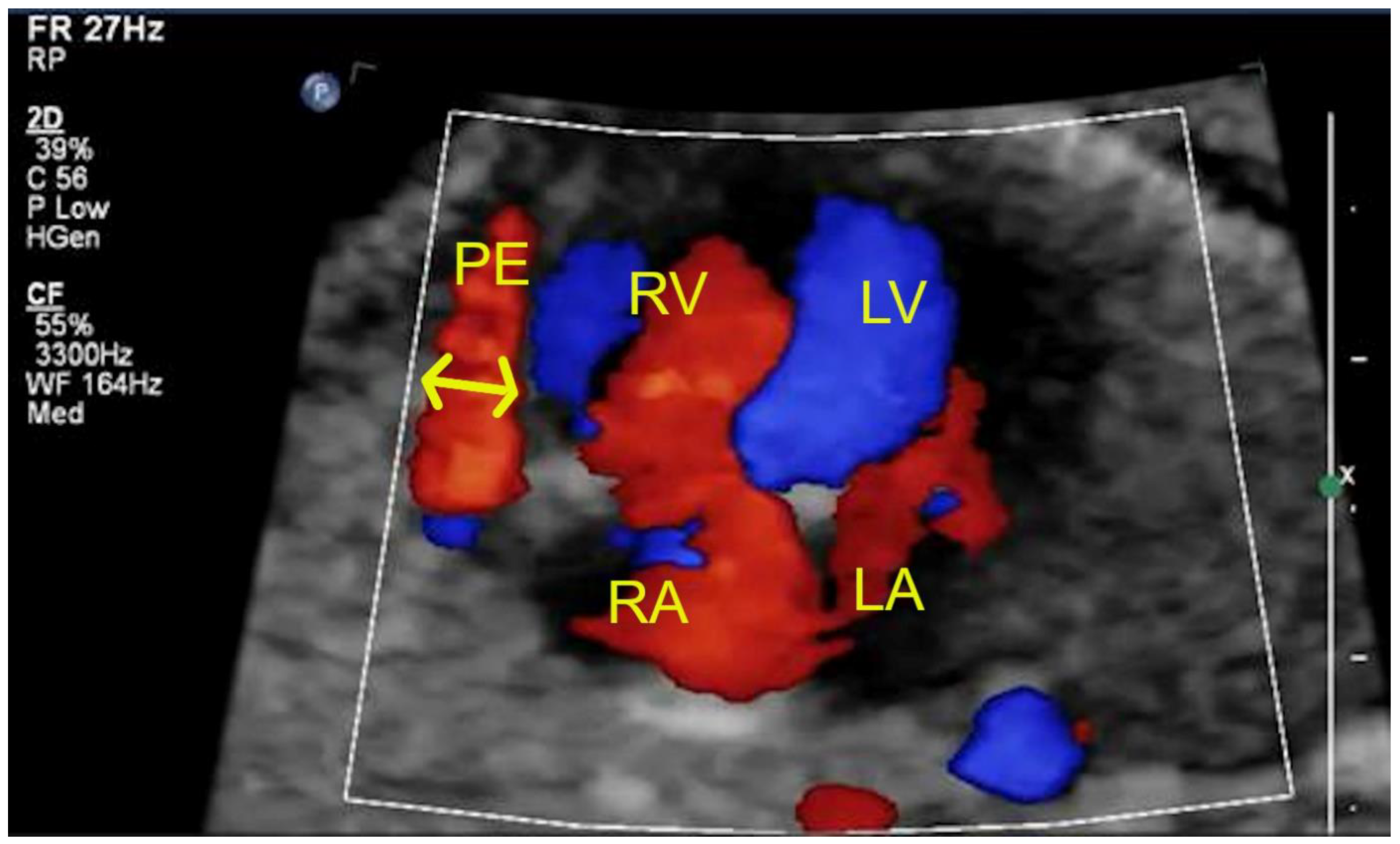 Jcm 12 05186 g003 Jcm 12 05186 g003