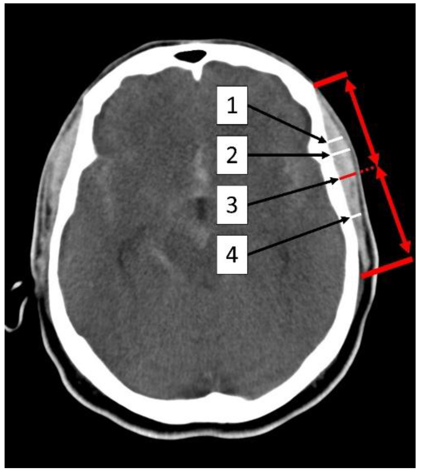 Jcm 12 05210 g001 Jcm 12 05210 g001