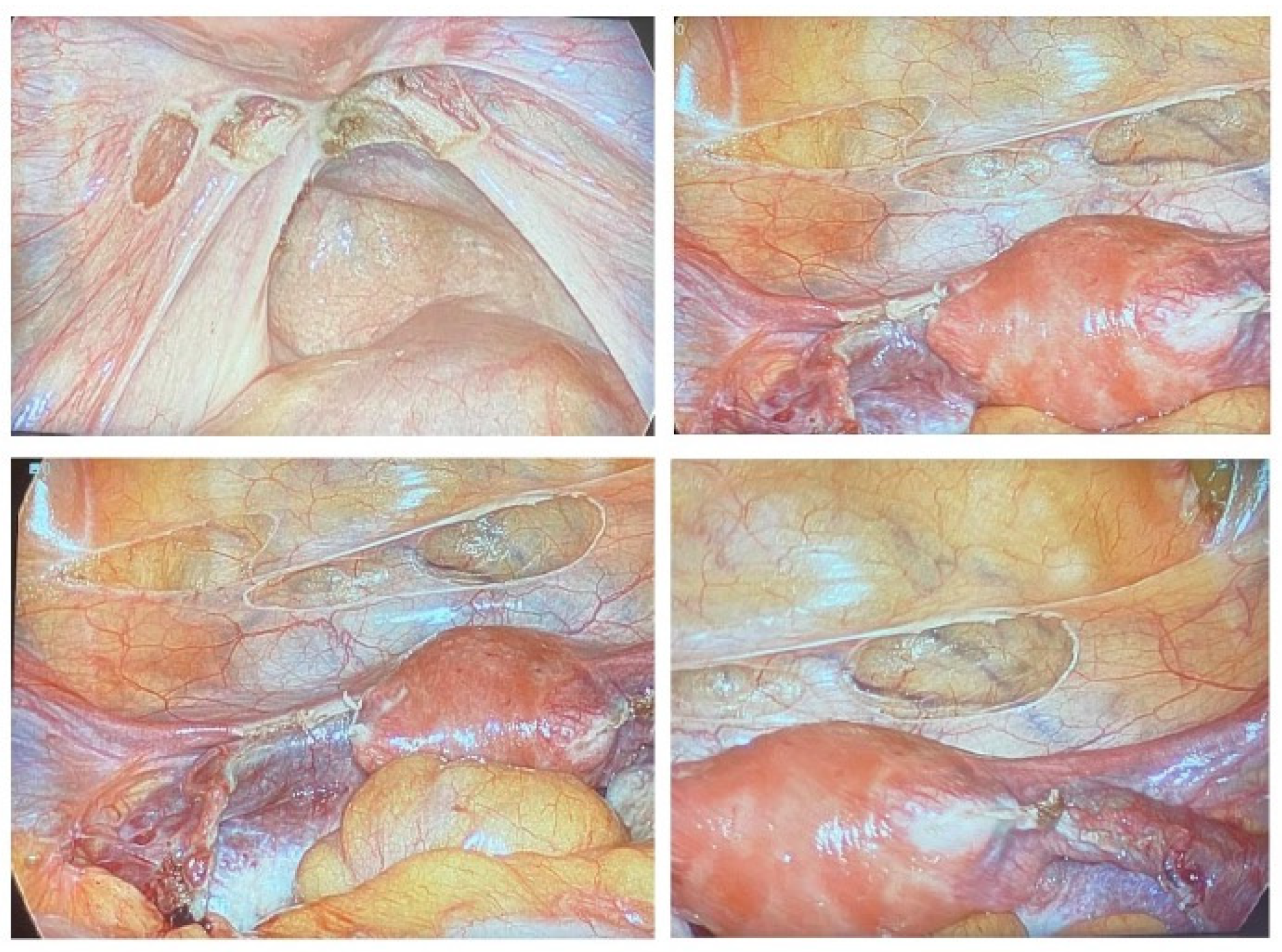 Jcm 12 05234 g001 Jcm 12 05234 g001