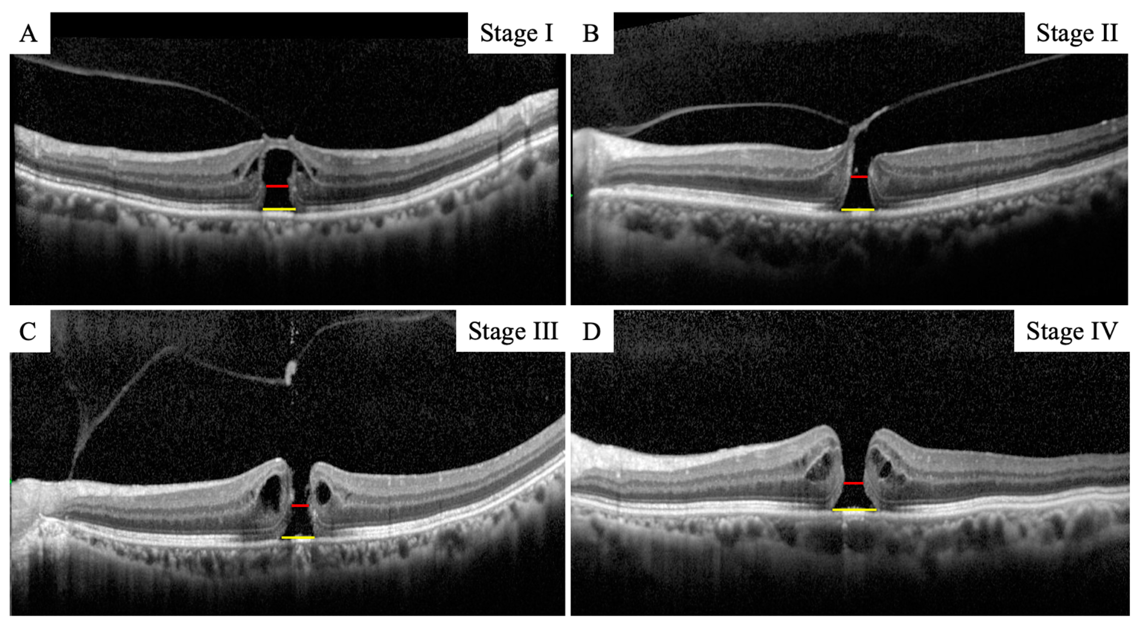 Jcm 12 05282 g001 Jcm 12 05282 g001