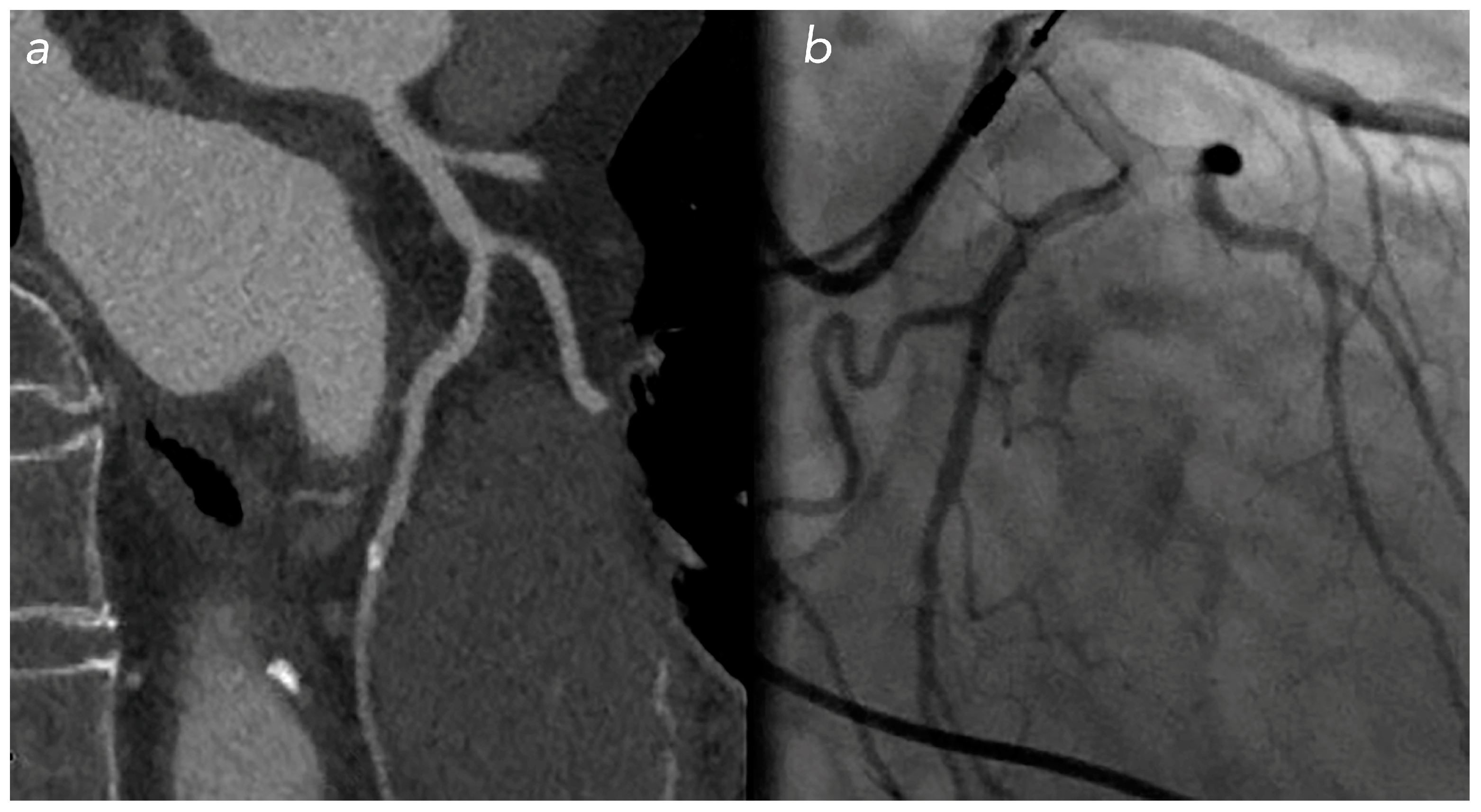 Jcm 12 05296 g005 Jcm 12 05296 g005