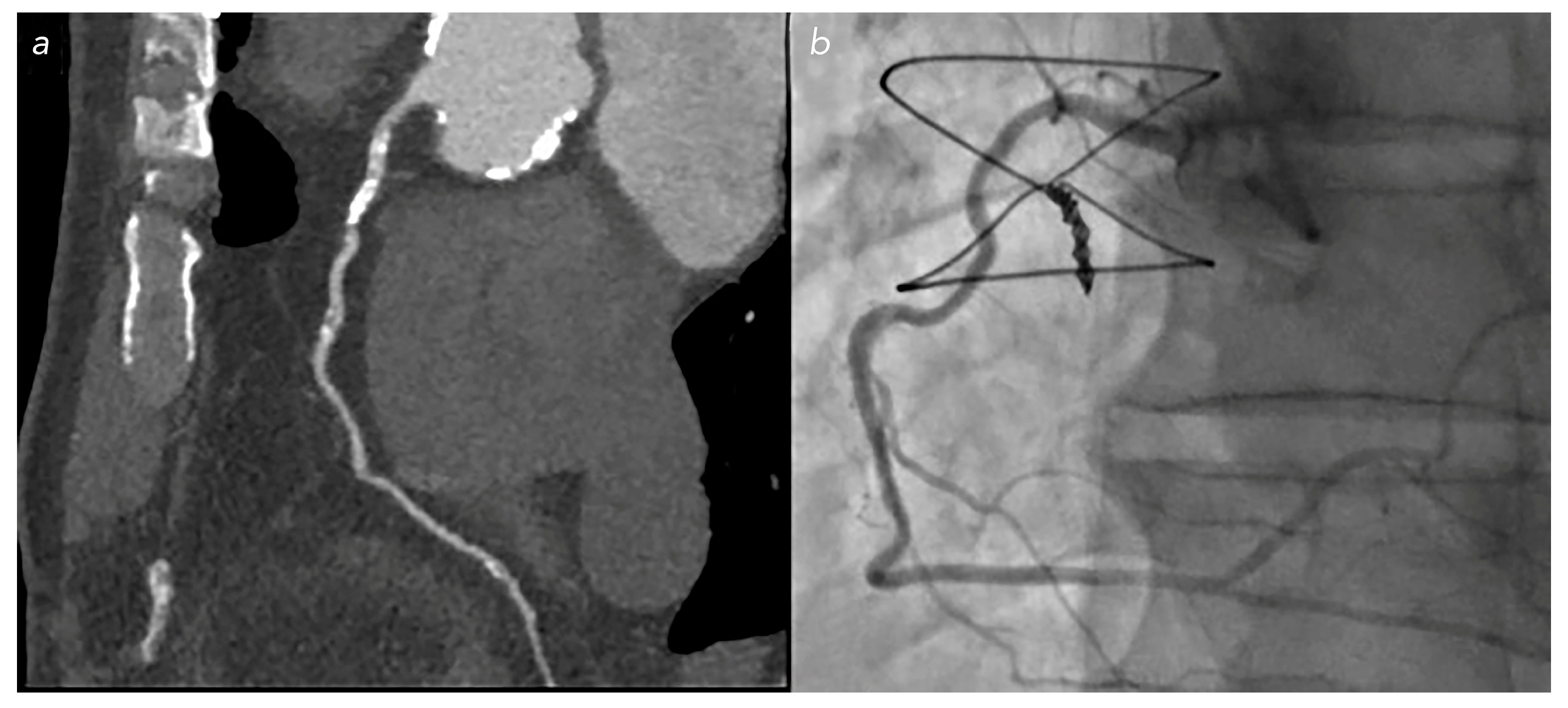 Jcm 12 05296 g006 Jcm 12 05296 g006