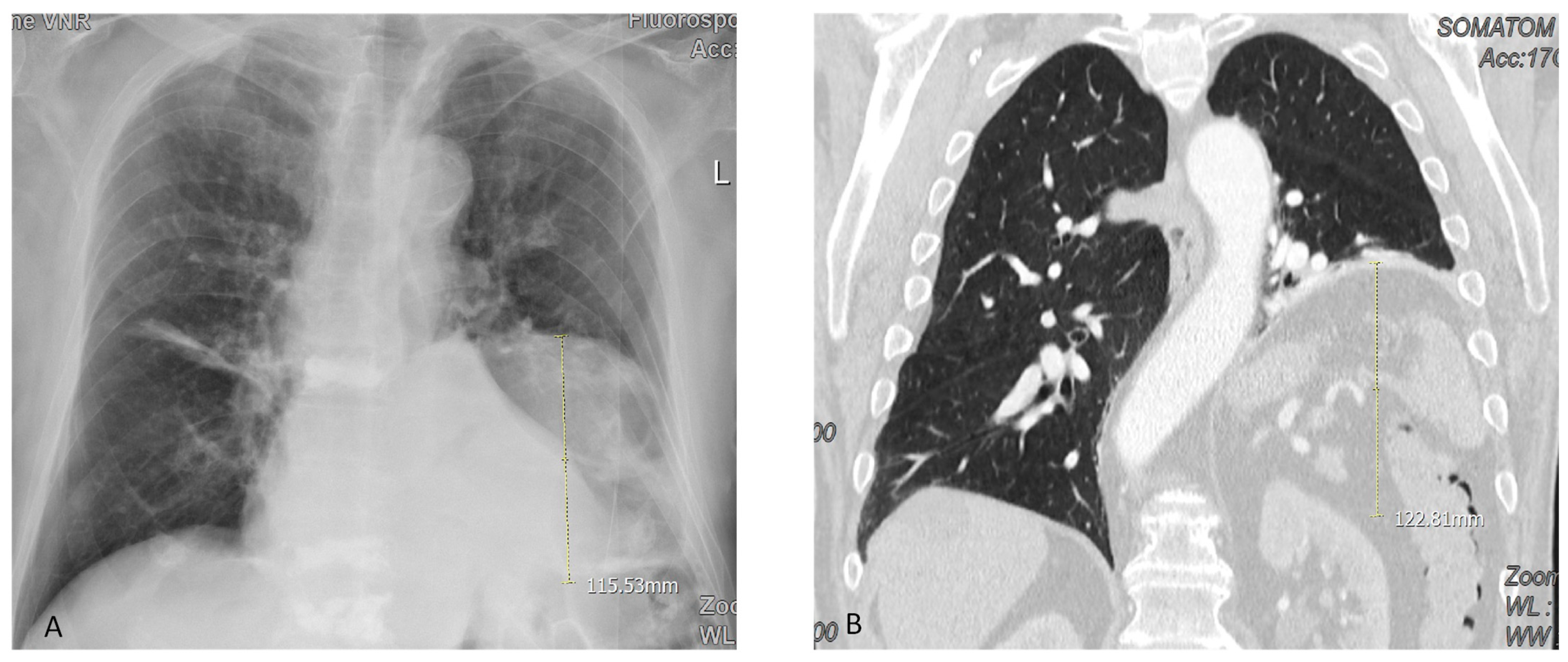 Jcm 12 05301 g002 Jcm 12 05301 g002