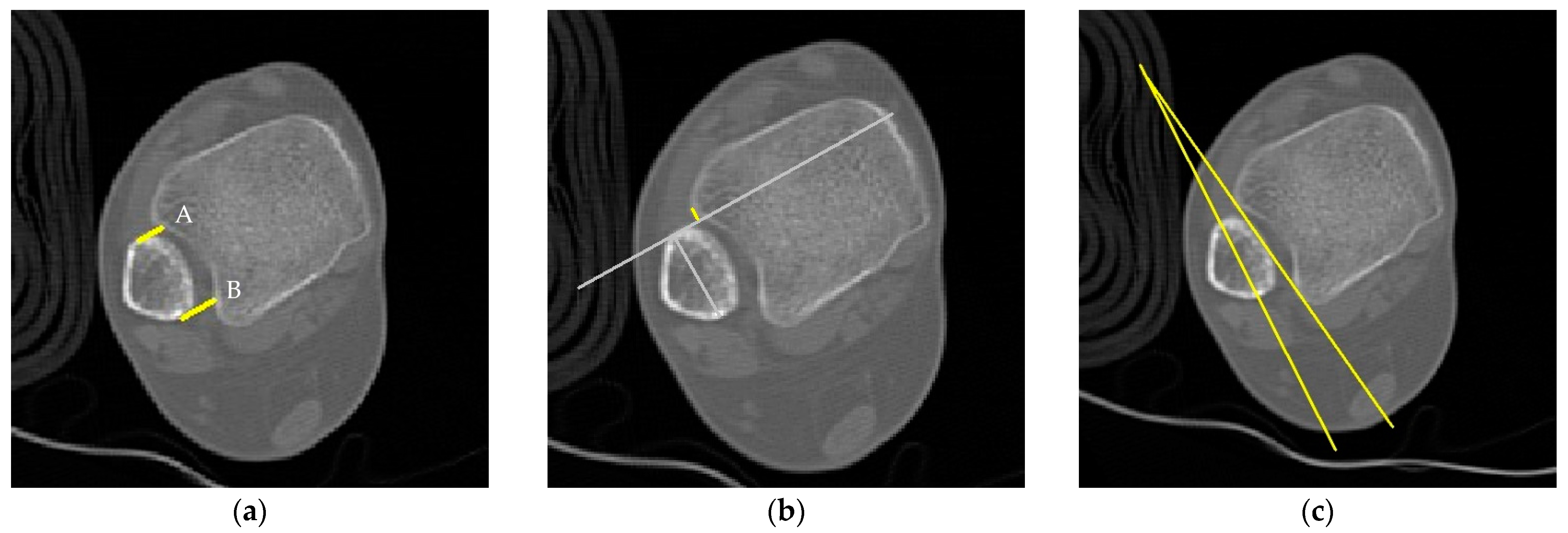 Jcm 12 05490 g001 Jcm 12 05490 g001