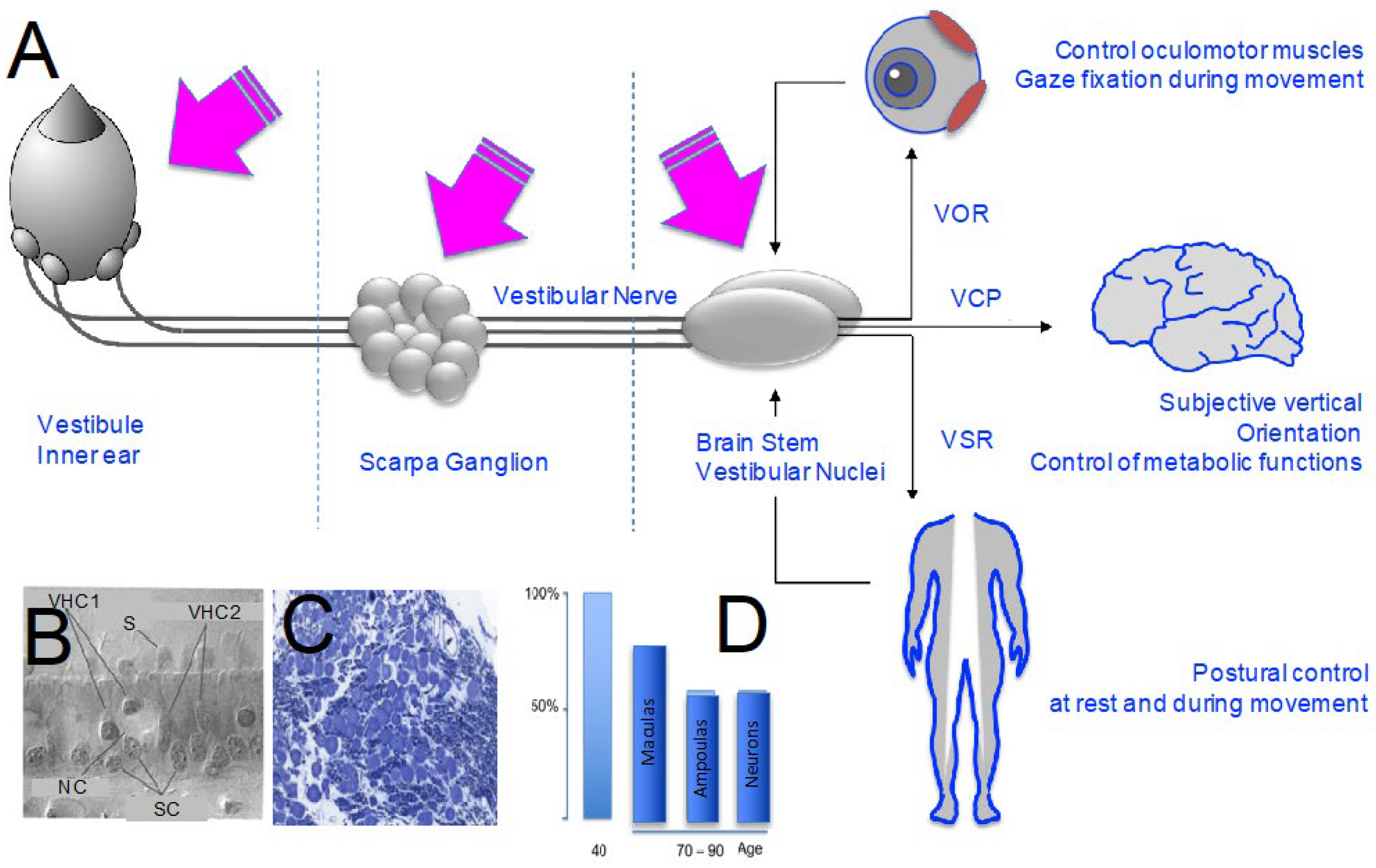 gabapentin for vestibular neuritis