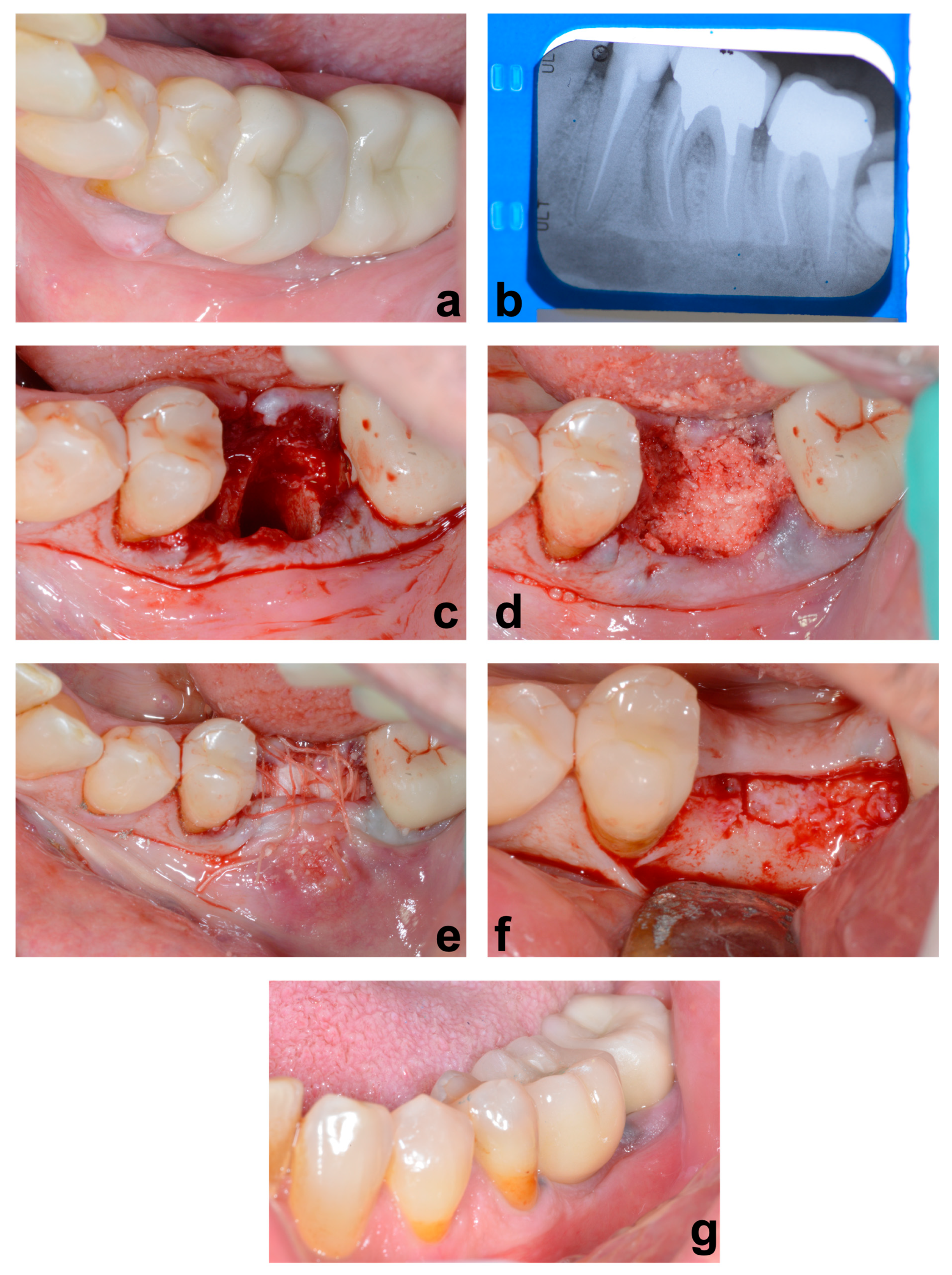 Jcm 12 05611 g002 Jcm 12 05611 g002