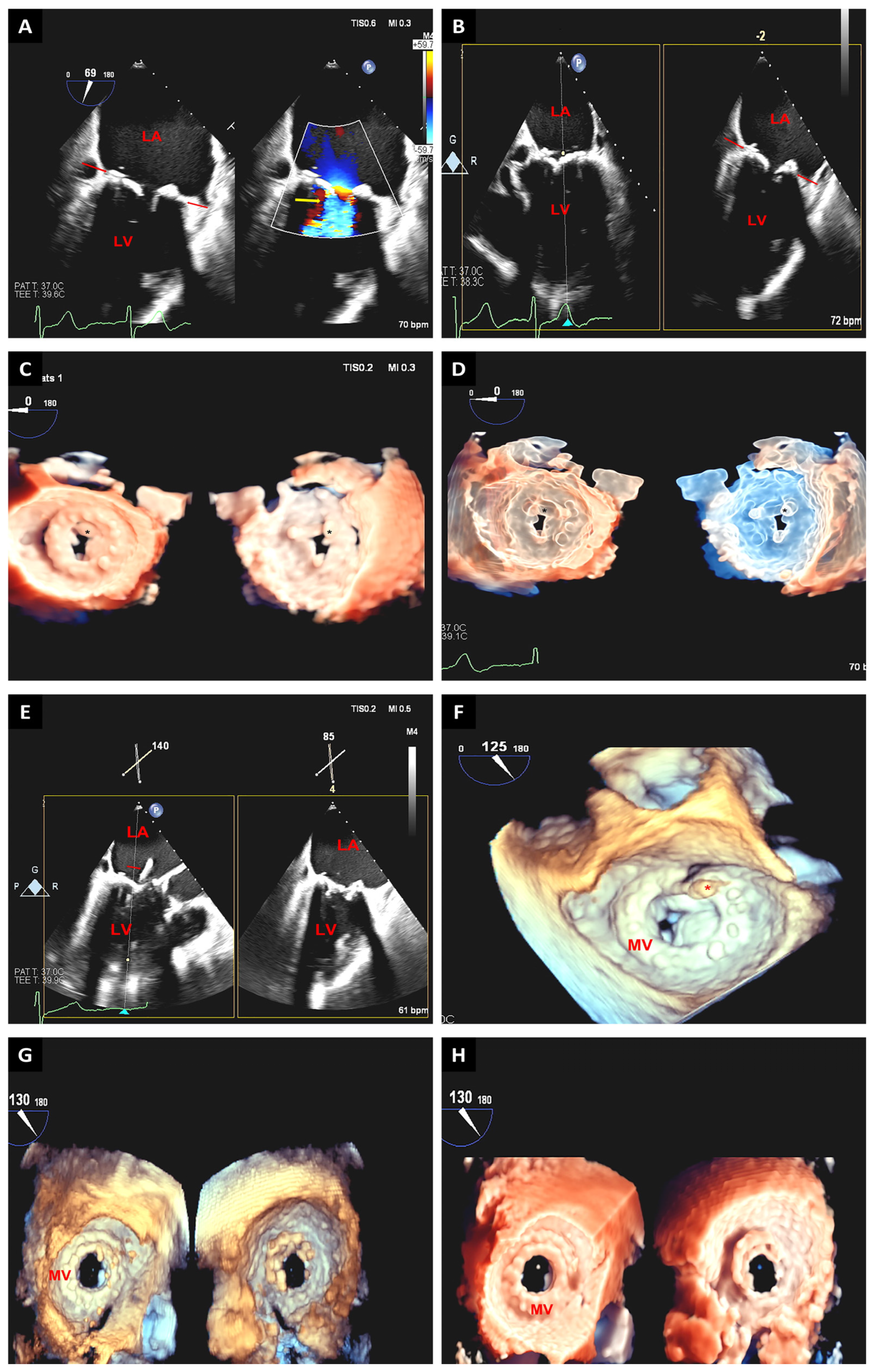 Jcm 12 05664 g005 Jcm 12 05664 g005