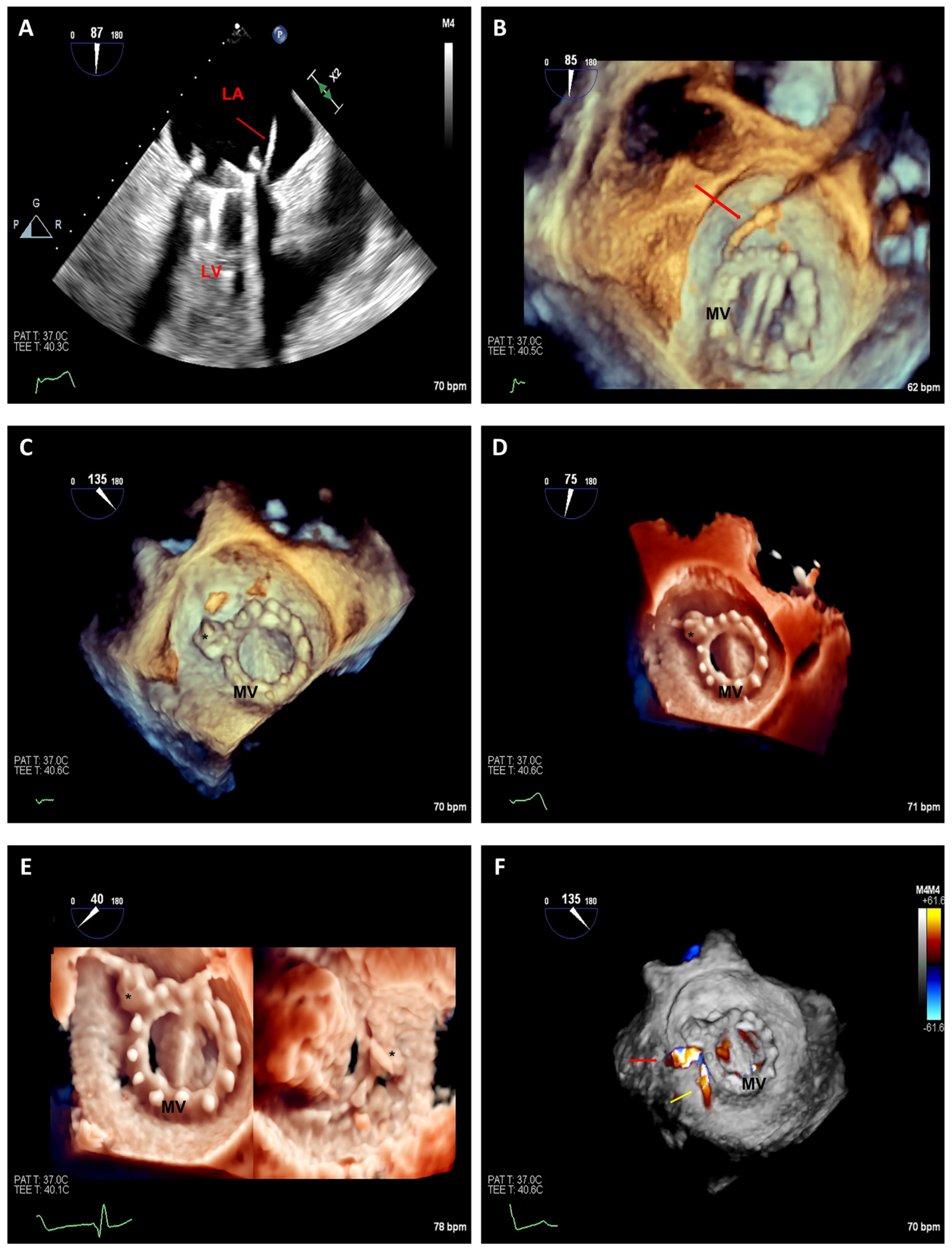Jcm 12 05664 g007 Jcm 12 05664 g007