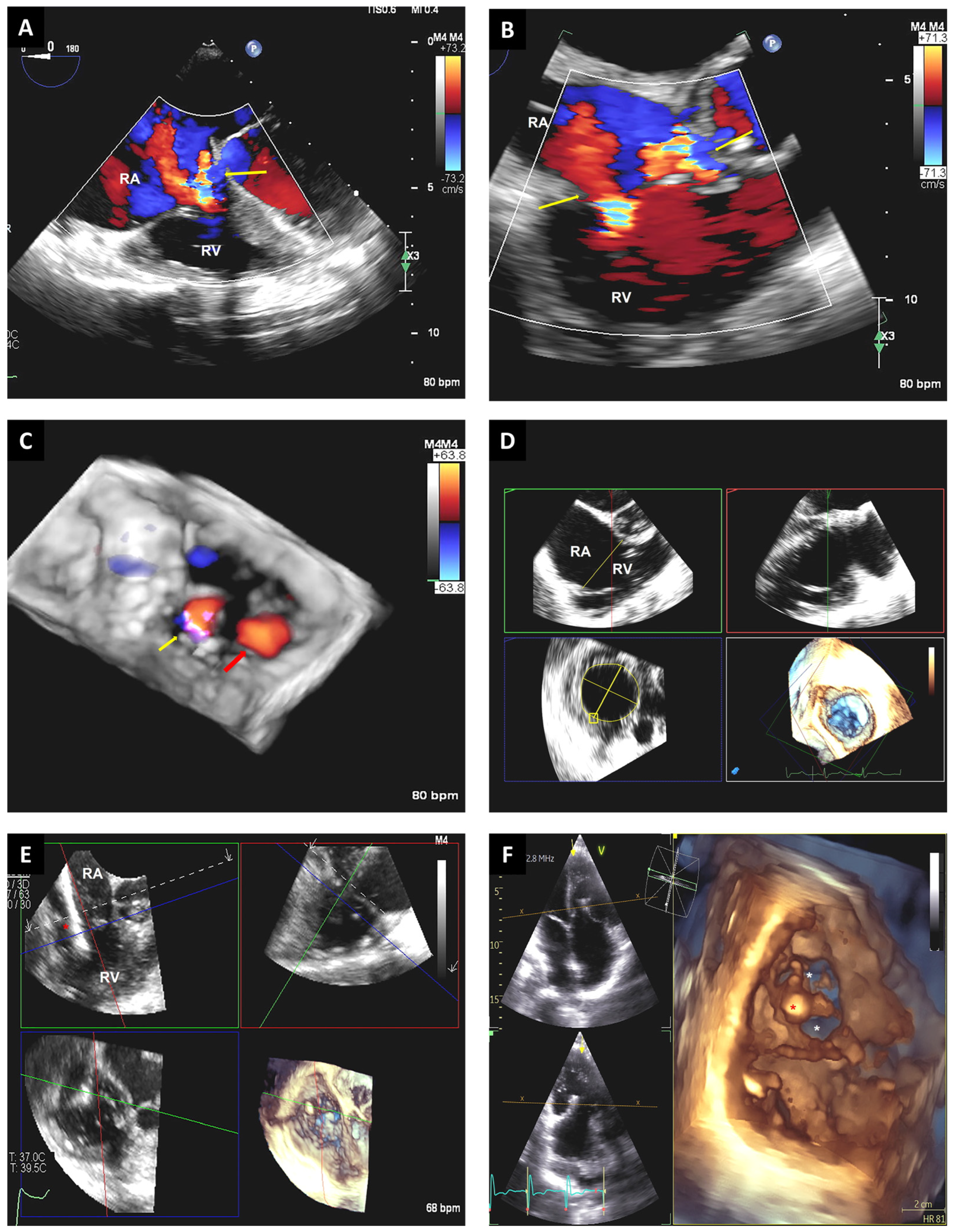 Jcm 12 05664 g008 Jcm 12 05664 g008