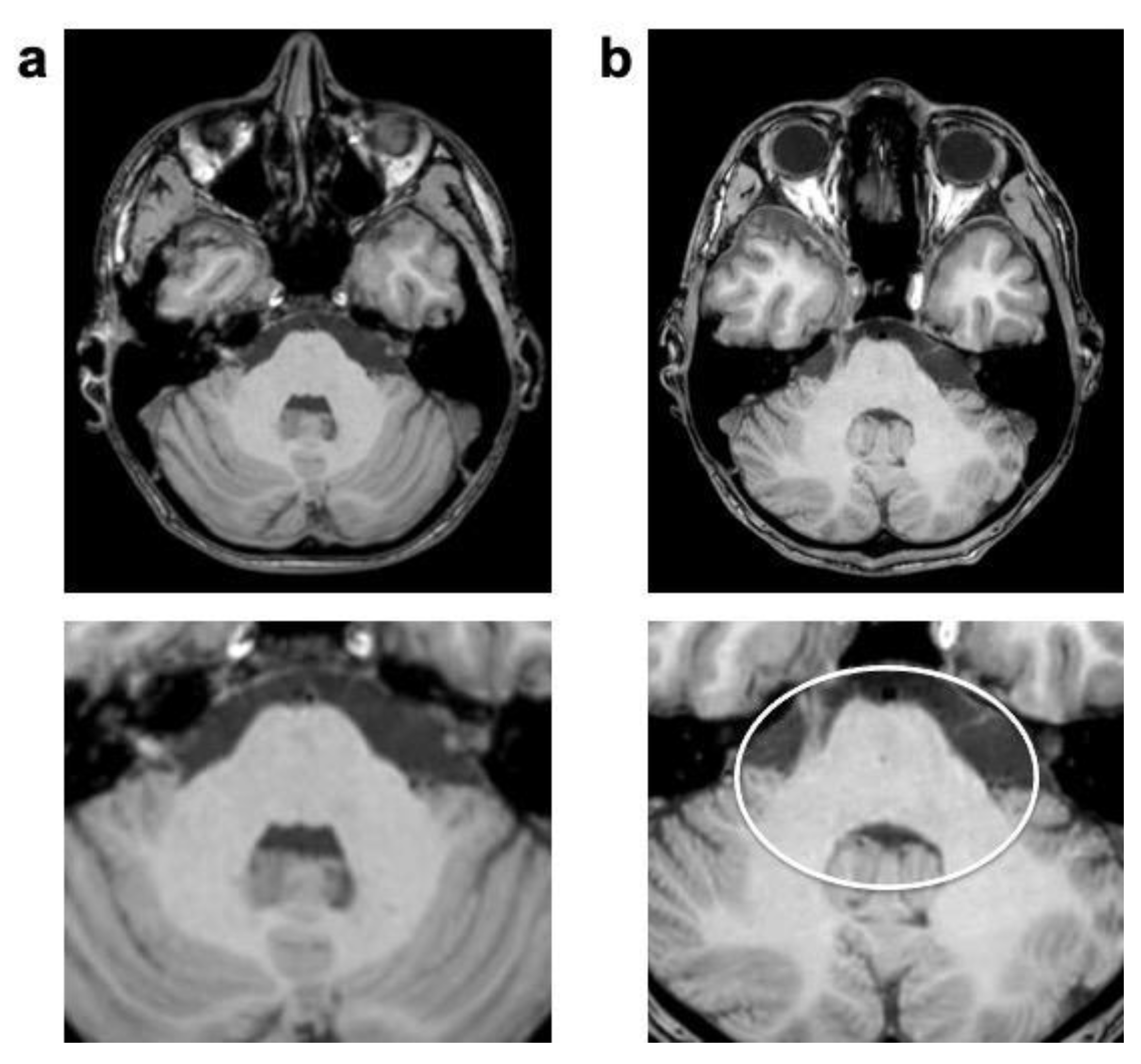 Jcm 12 05732 g004 Jcm 12 05732 g004